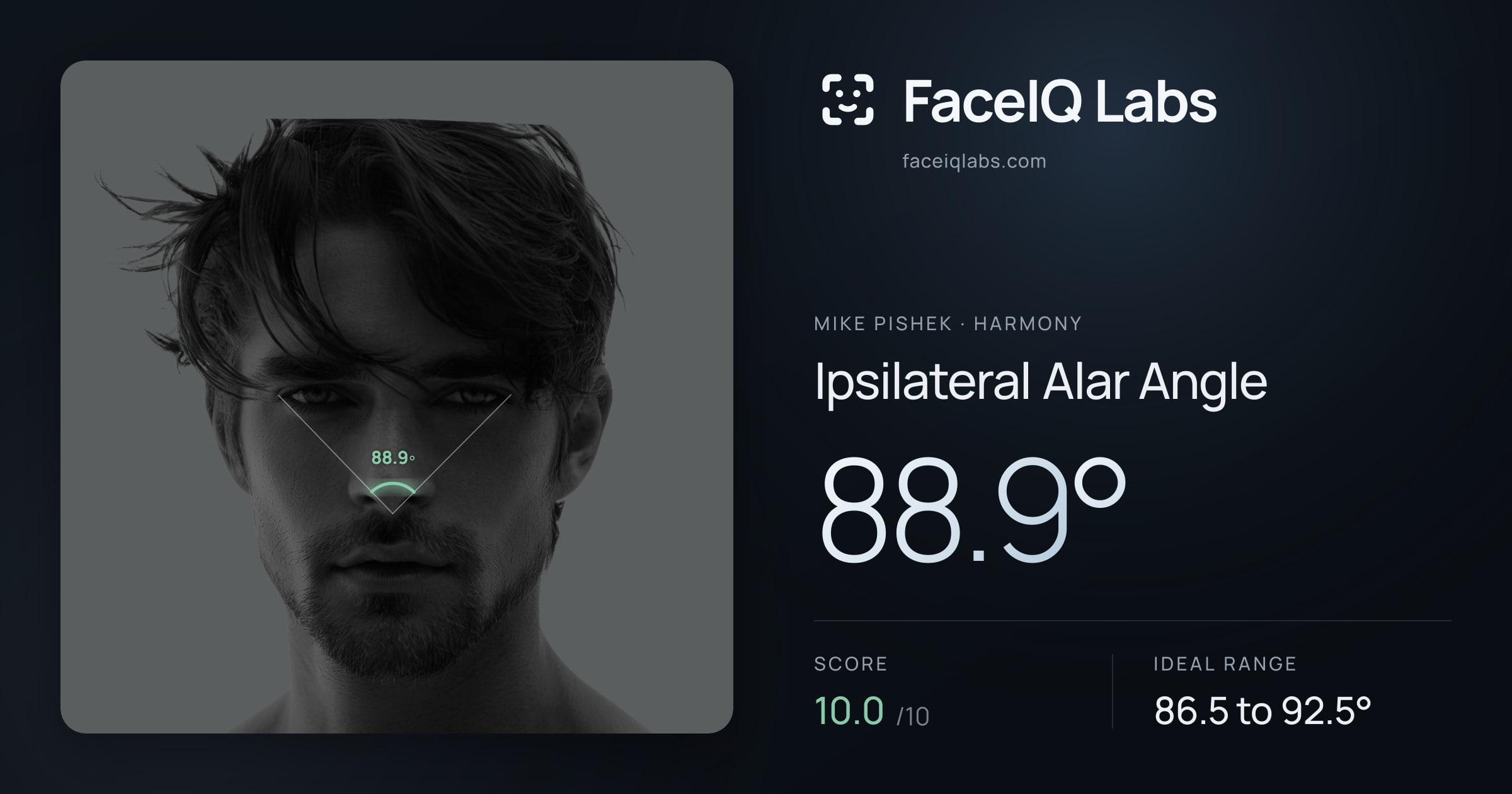Mike Pishek Ipsilateral Alar Angle: 88.9°, drawn on the photo