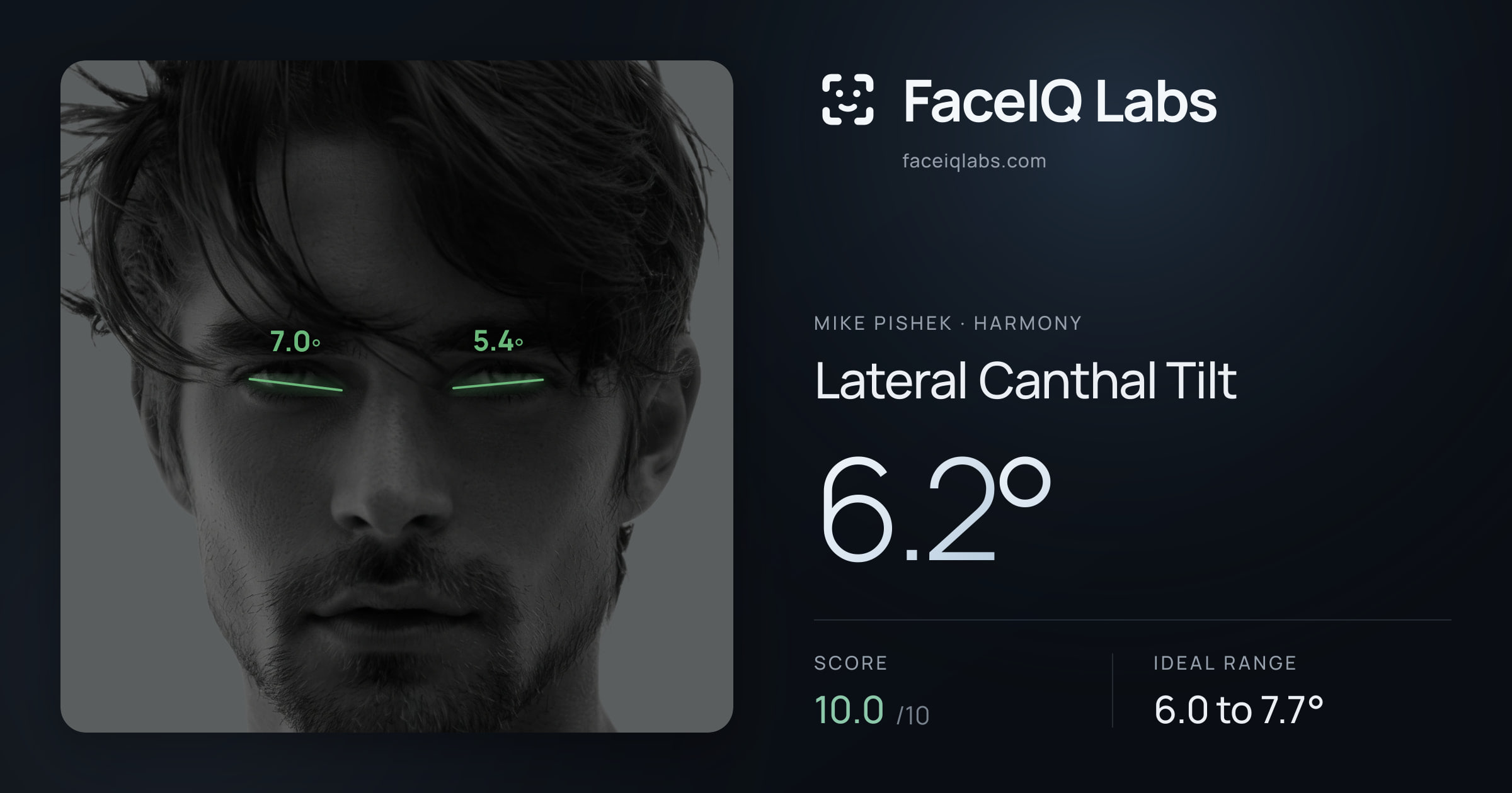 Mike Pishek Lateral Canthal Tilt: 6.2°, drawn on the photo
