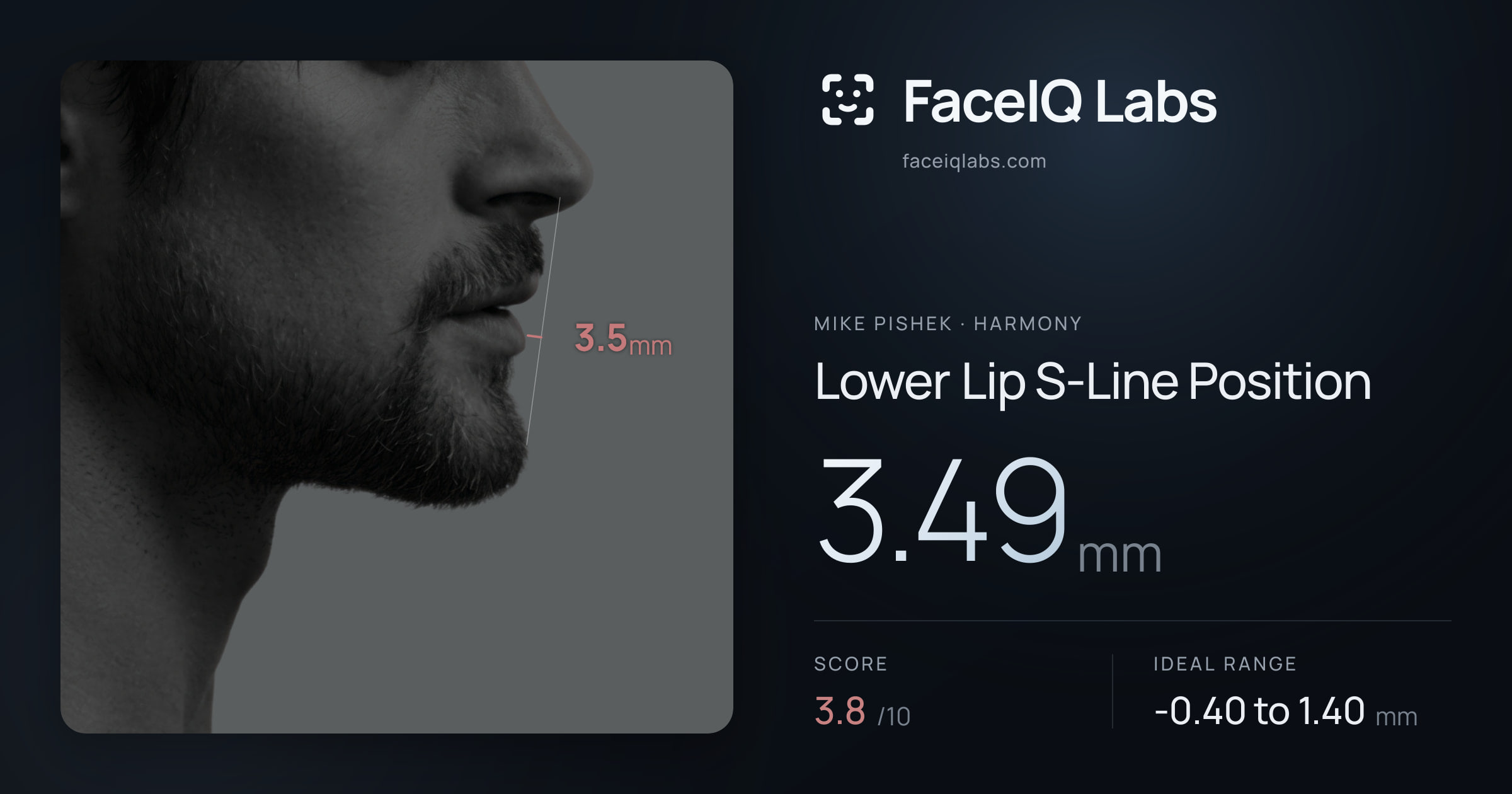 Mike Pishek Lower Lip S-Line Position: 3.49mm, drawn on the photo