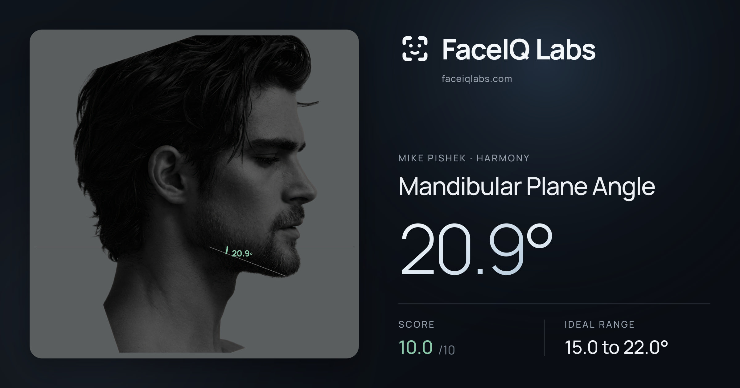 Mike Pishek Mandibular Plane Angle: 20.9°, drawn on the photo