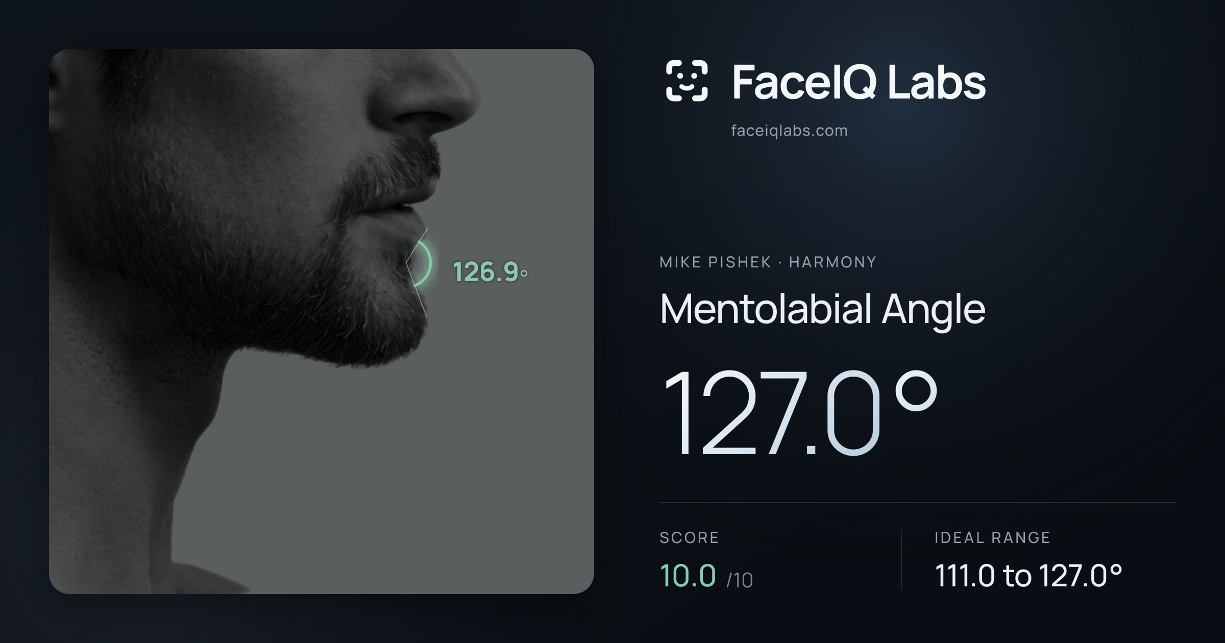 Mike Pishek Mentolabial Angle: 127.0°, drawn on the photo