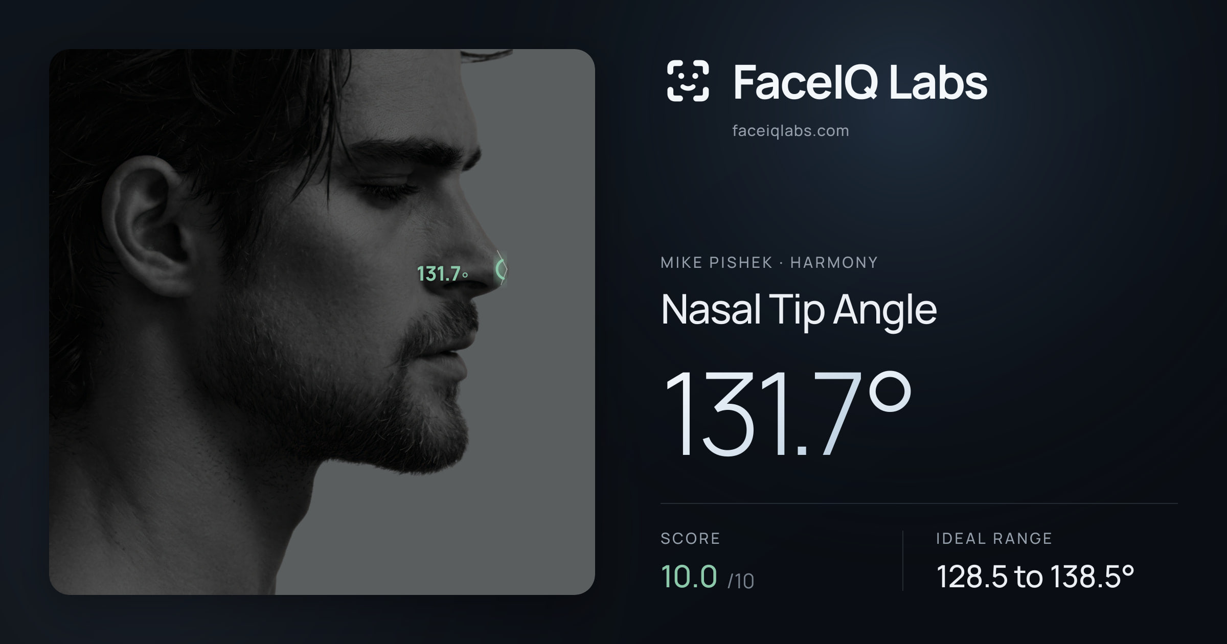 Mike Pishek Nasal Tip Angle: 131.7°, drawn on the photo