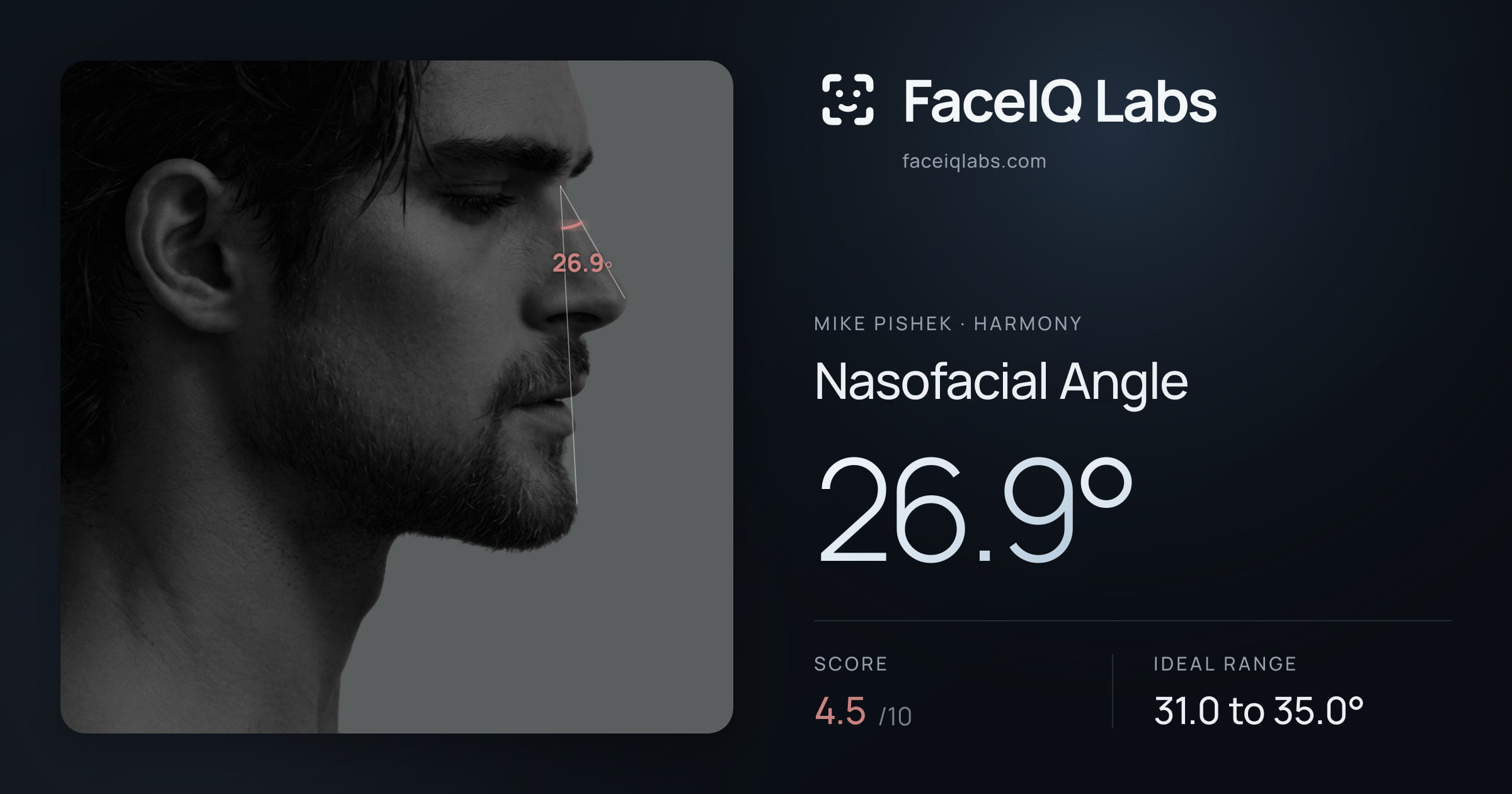 Mike Pishek Nasofacial Angle: 26.9°, drawn on the photo