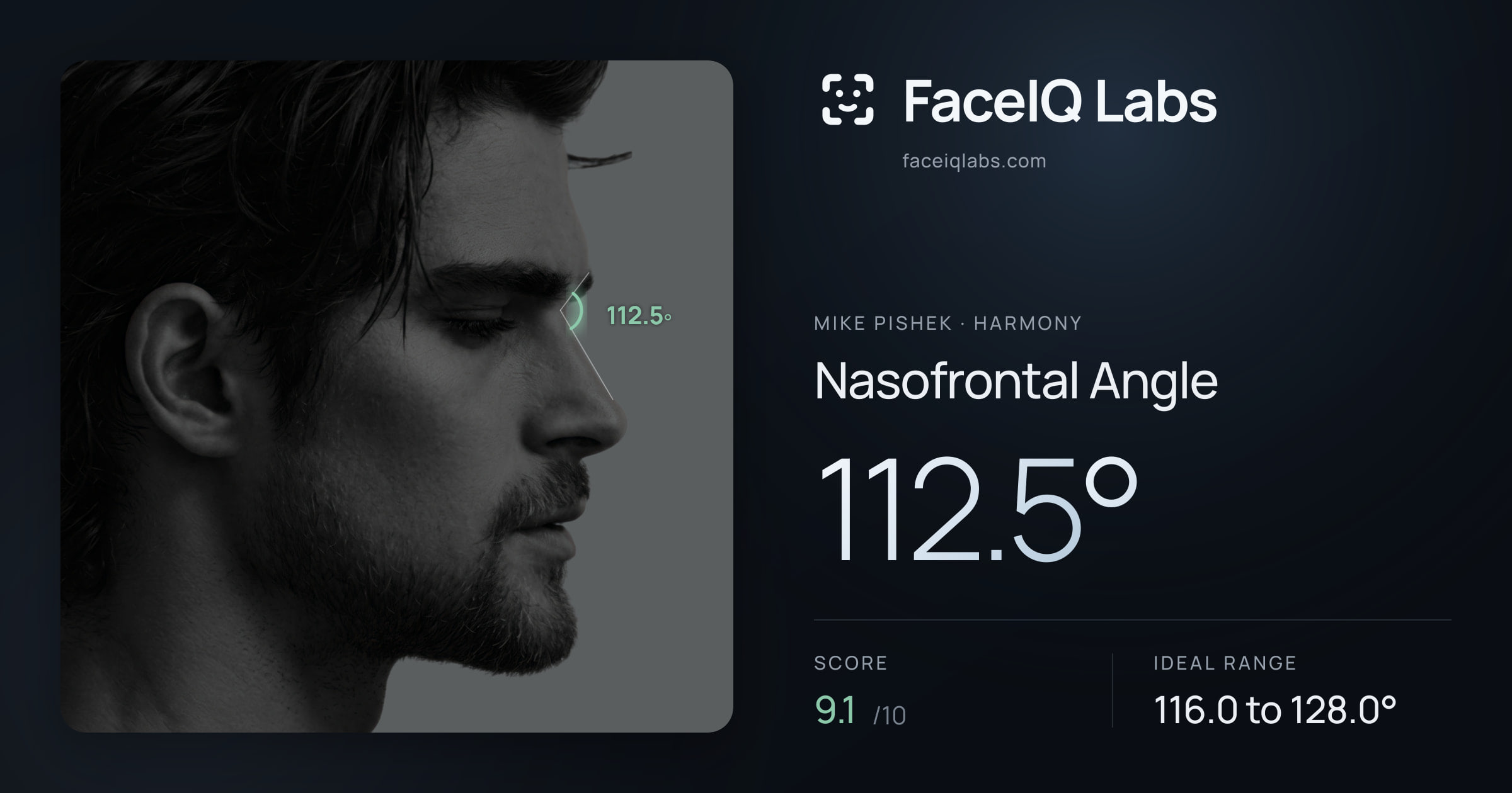 Mike Pishek Nasofrontal Angle: 112.5°, drawn on the photo
