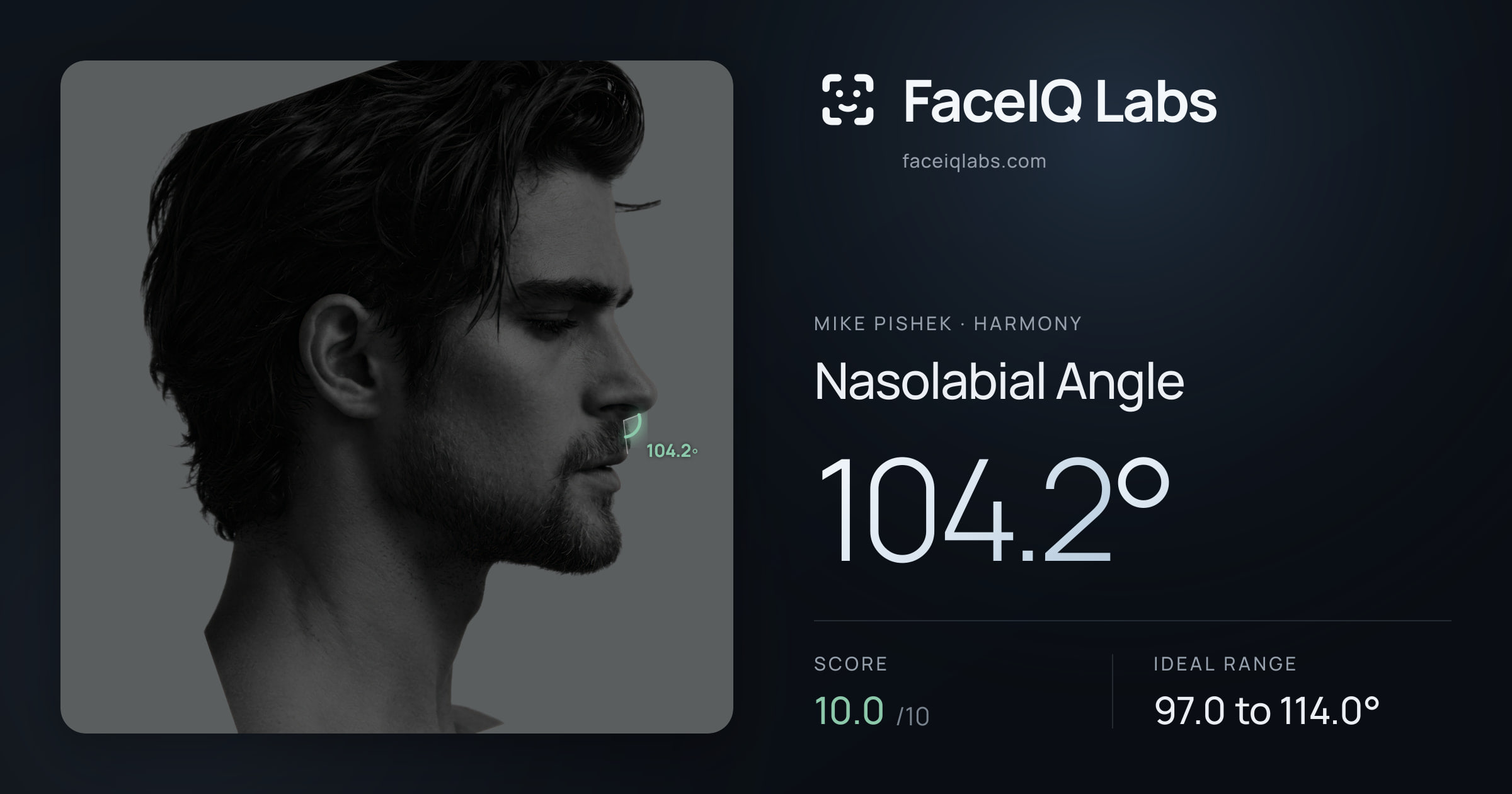 Mike Pishek Nasolabial Angle: 104.2°, drawn on the photo