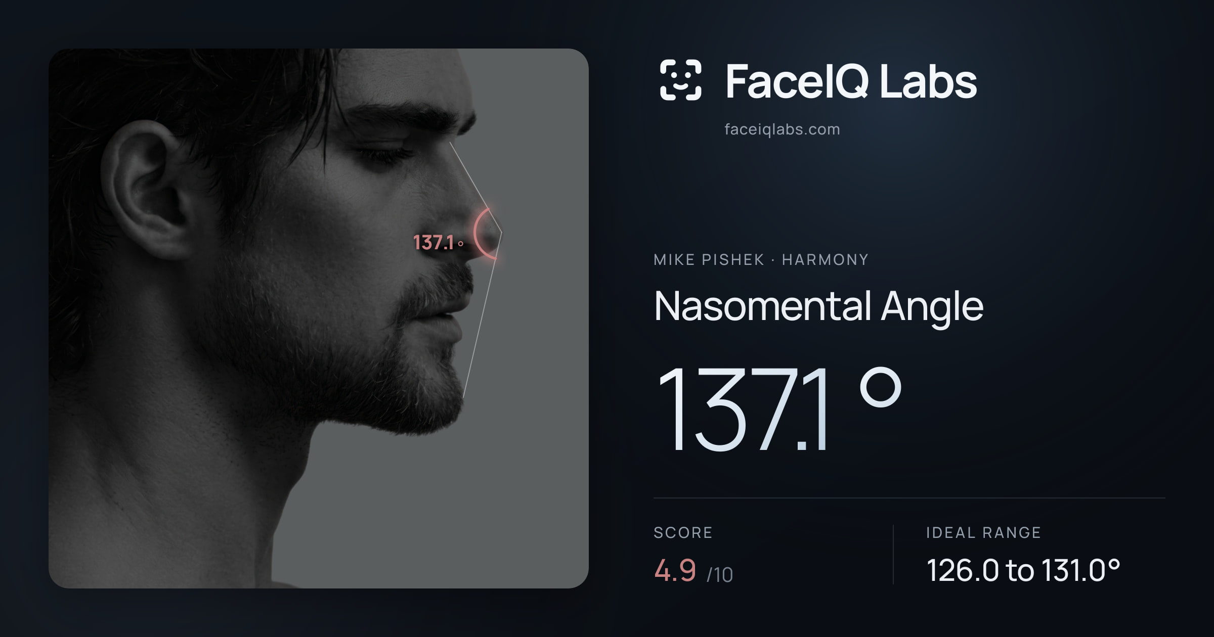 Mike Pishek Nasomental Angle: 137.1°, drawn on the photo