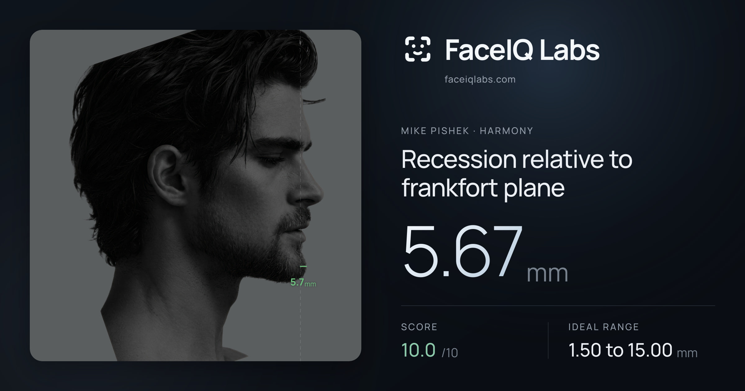 Mike Pishek Recession relative to frankfort plane: 5.67mm, drawn on the photo
