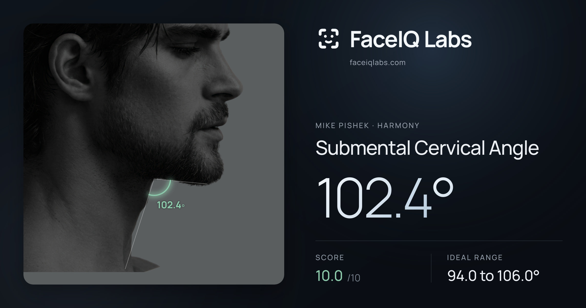 Mike Pishek Submental Cervical Angle: 102.4°, drawn on the photo