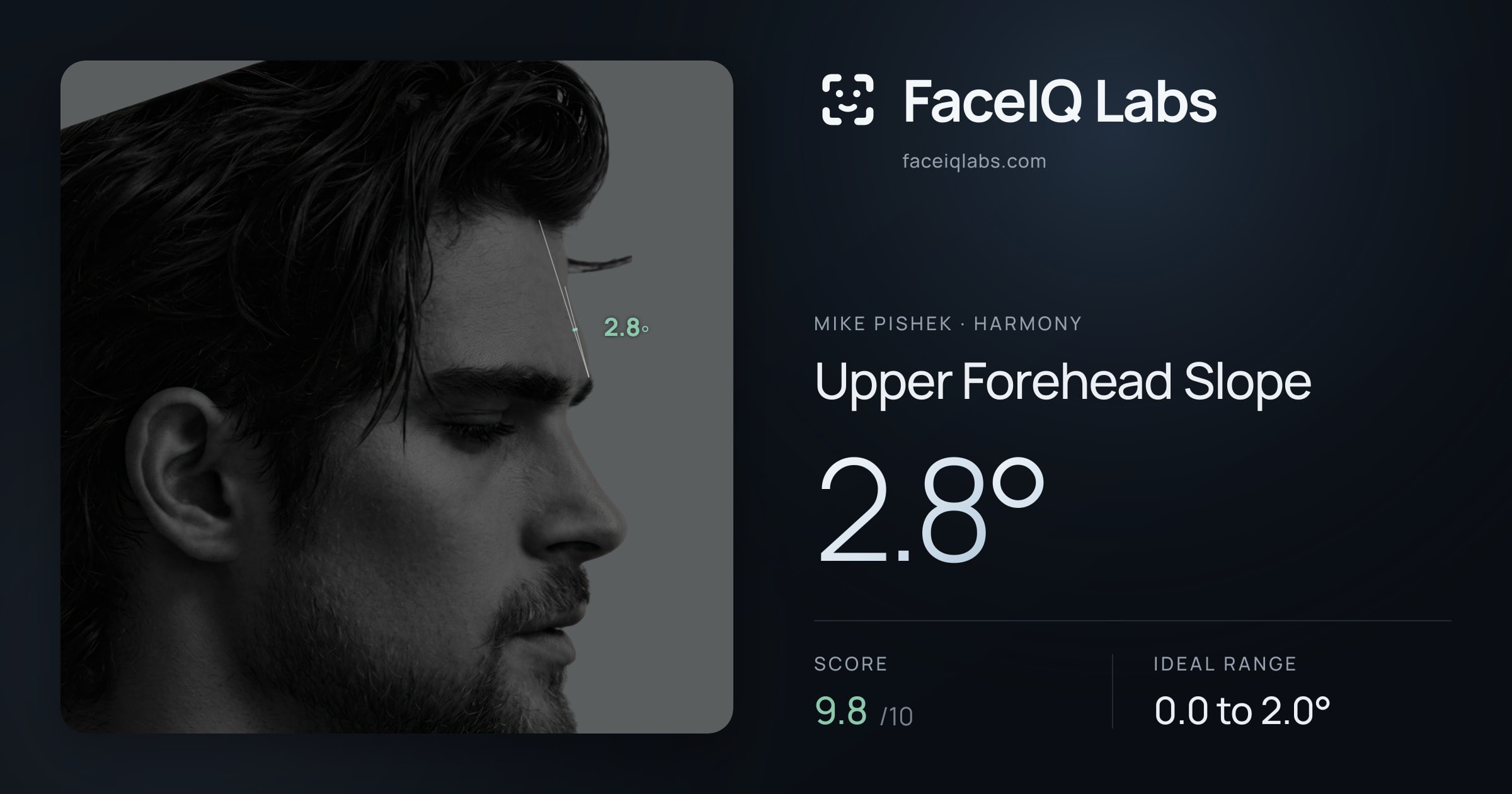 Mike Pishek Upper Forehead Slope: 2.8°, drawn on the photo