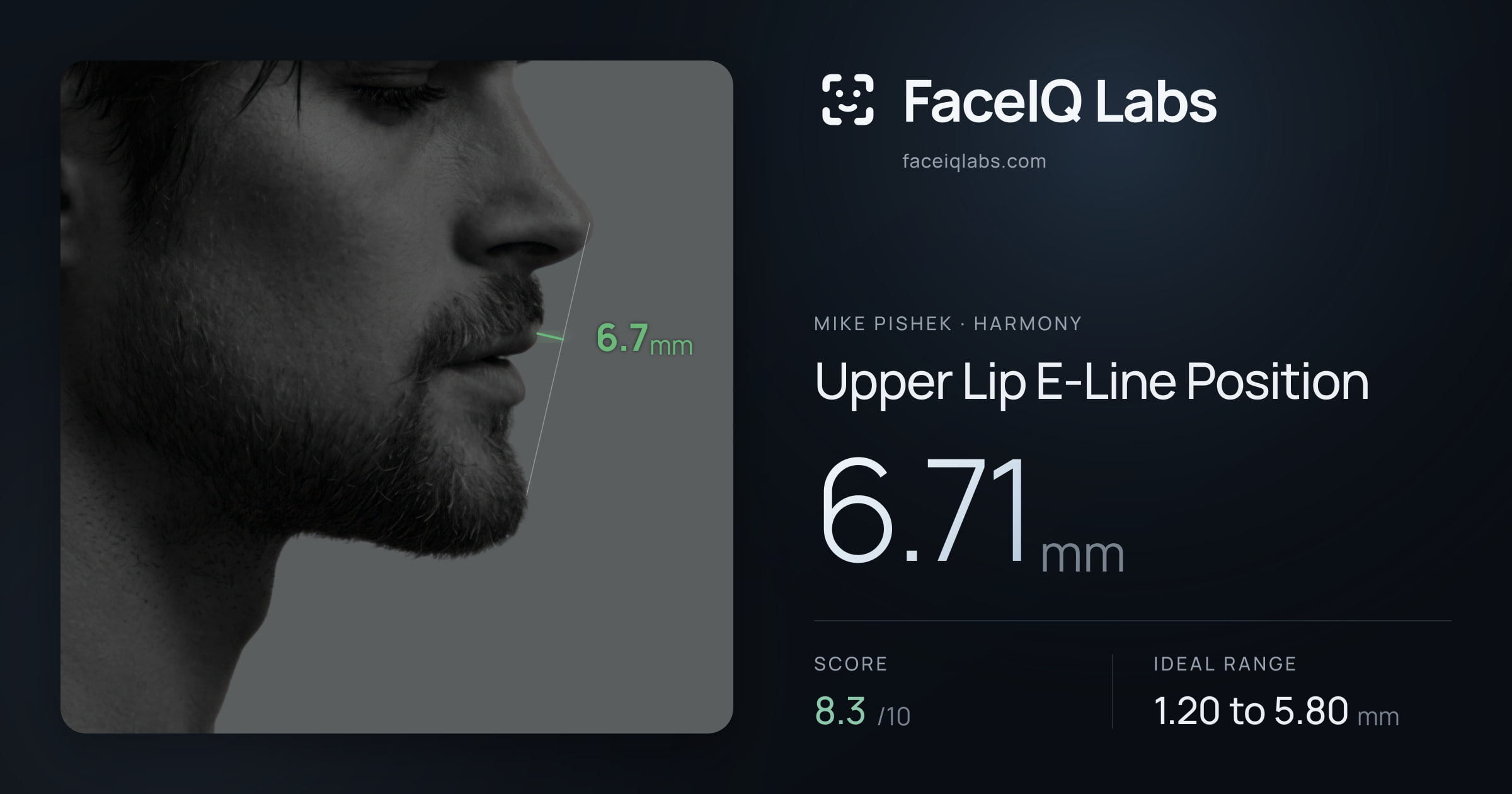 Mike Pishek Upper Lip E-Line Position: 6.71mm, drawn on the photo