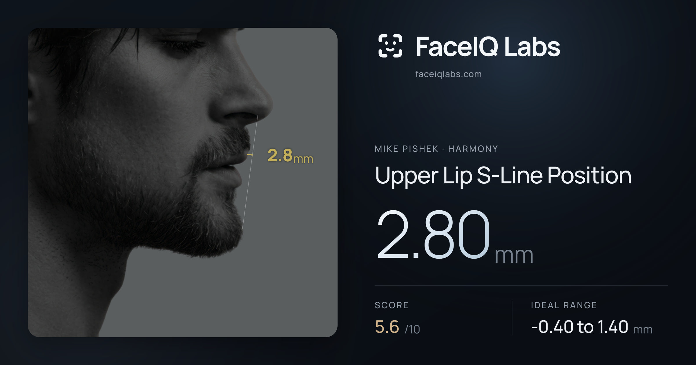 Mike Pishek Upper Lip S-Line Position: 2.80mm, drawn on the photo