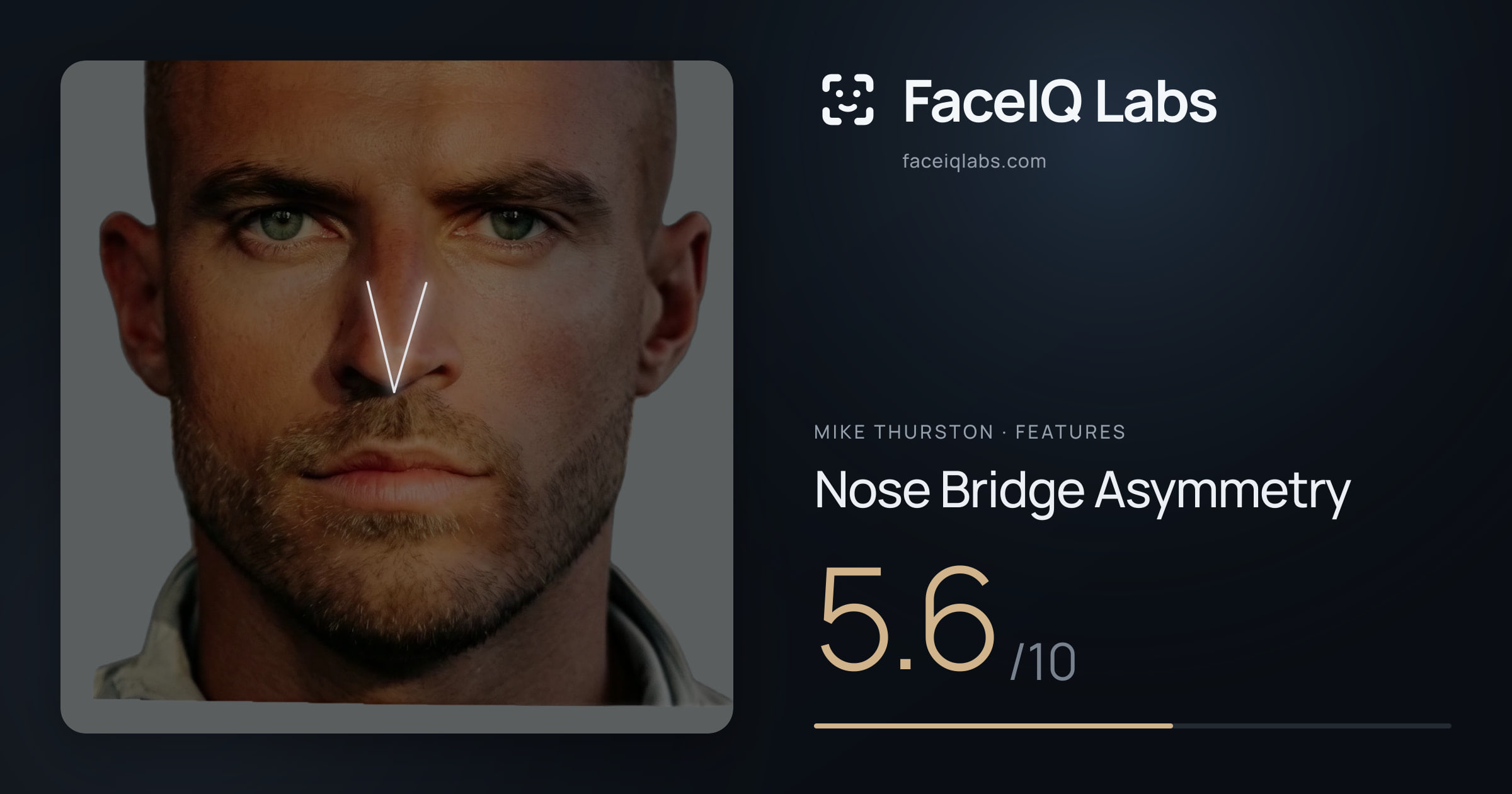 Mike Thurston Nose Bridge Asymmetry: 5.6/10, drawn on the photo