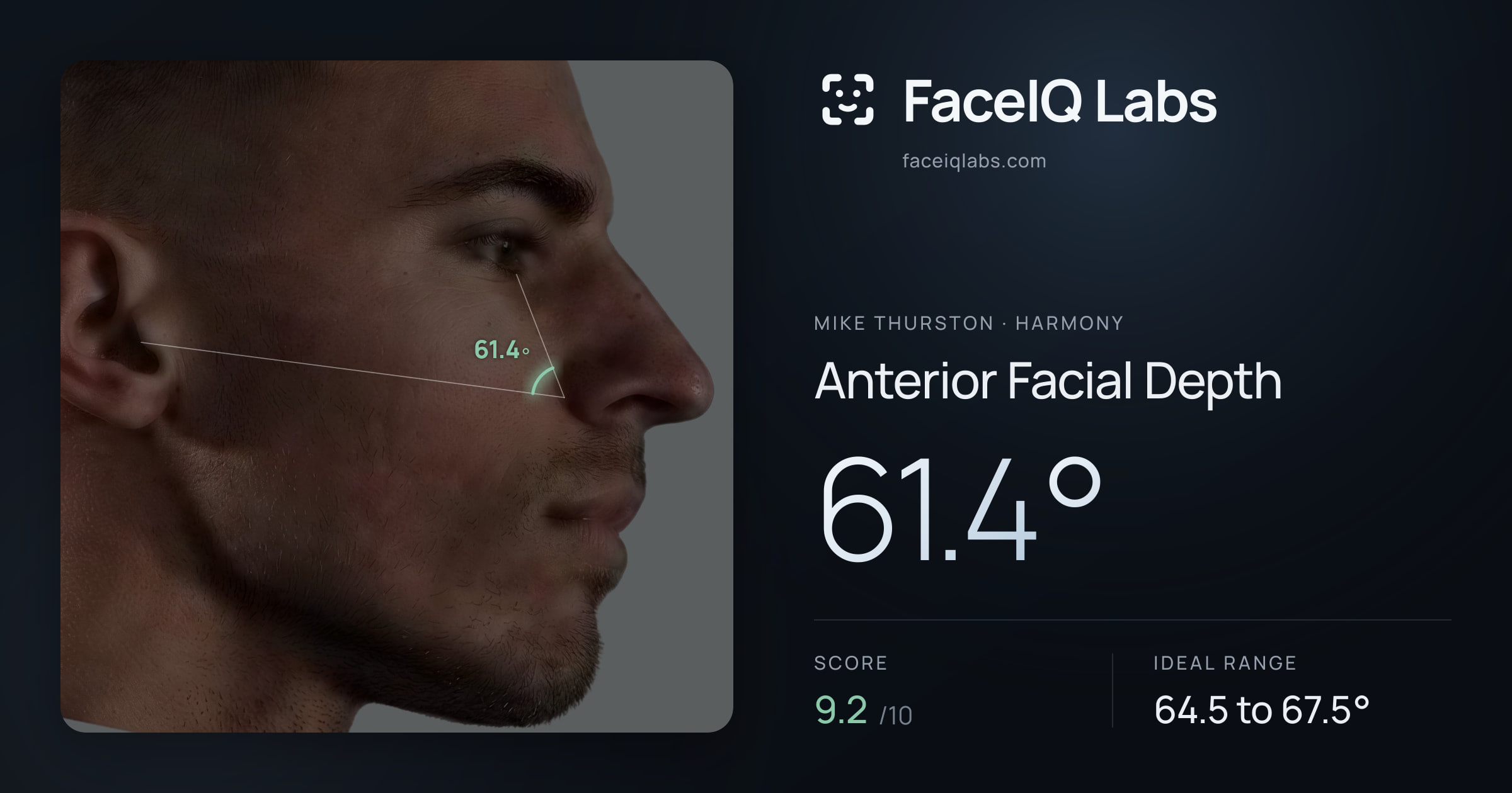 Mike Thurston Anterior Facial Depth: 61.4°, drawn on the photo