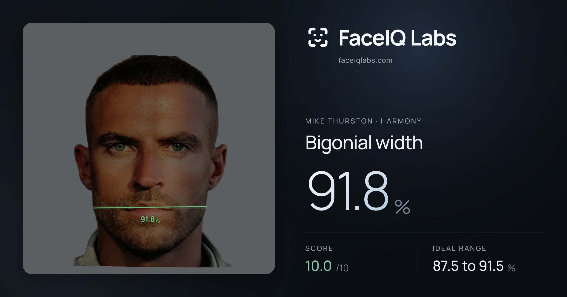 Mike Thurston Bigonial width: 91.8%, drawn on the photo