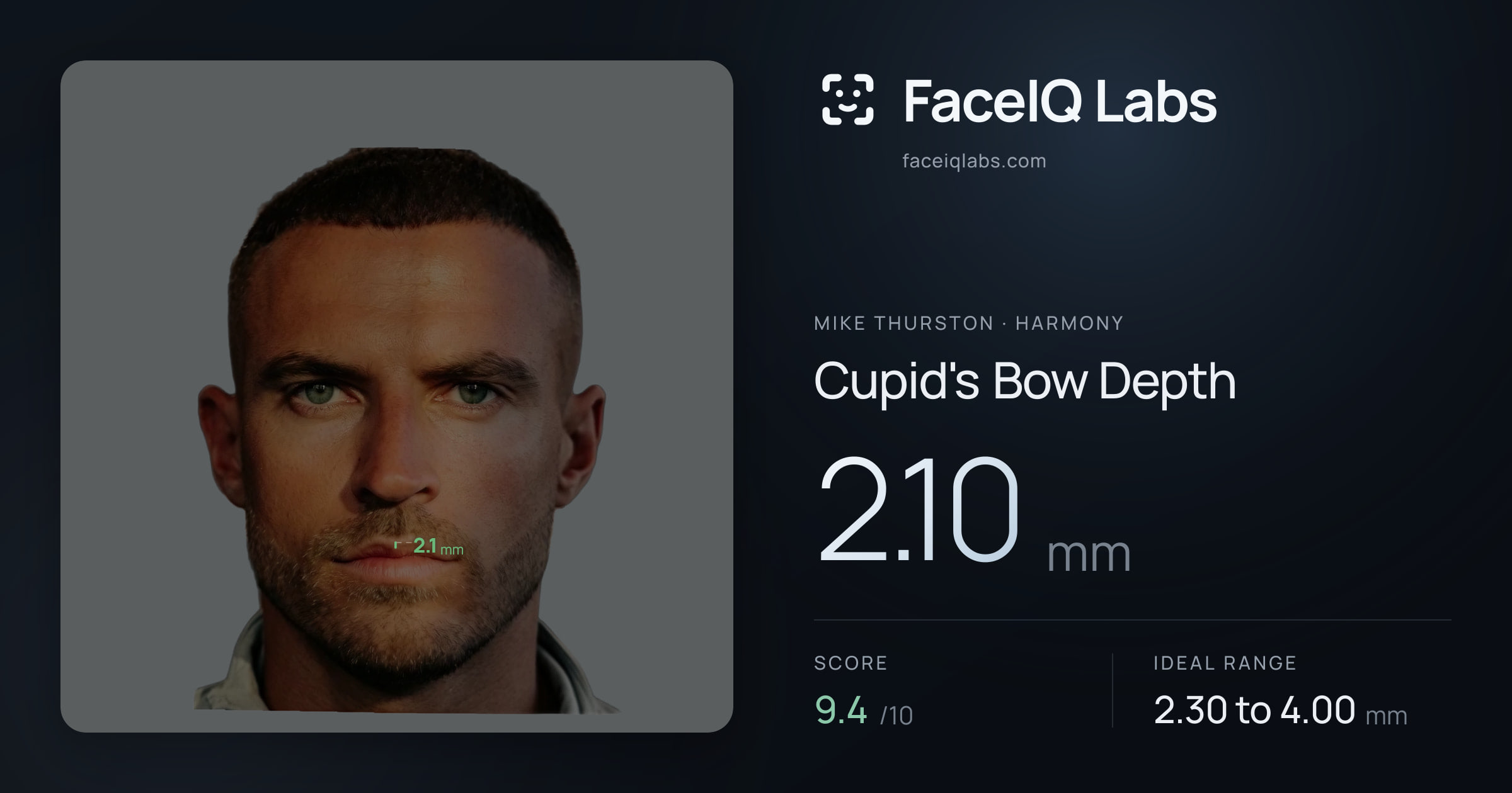 Mike Thurston Cupid's Bow Depth: 2.10mm, drawn on the photo