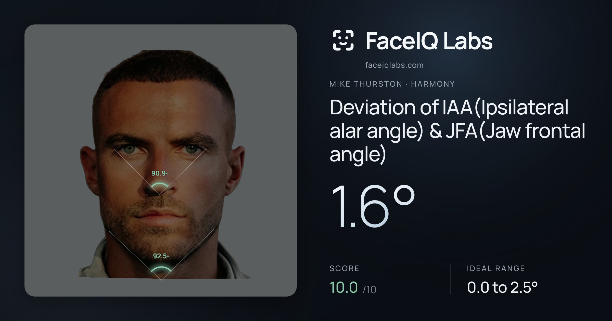Mike Thurston Deviation of IAA(Ipsilateral alar angle) & JFA(Jaw frontal angle): 1.6°, drawn on the photo