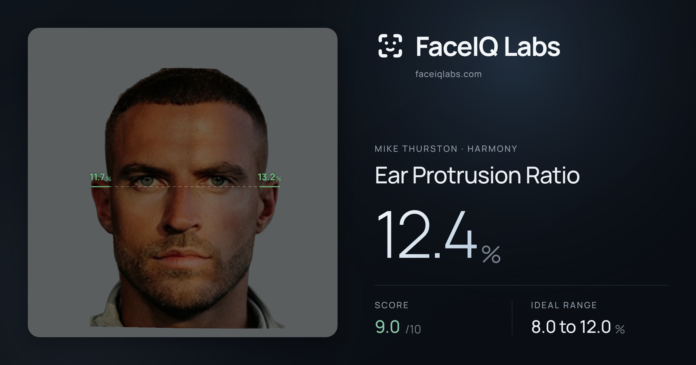 Mike Thurston Ear Protrusion Ratio: 12.4%, drawn on the photo