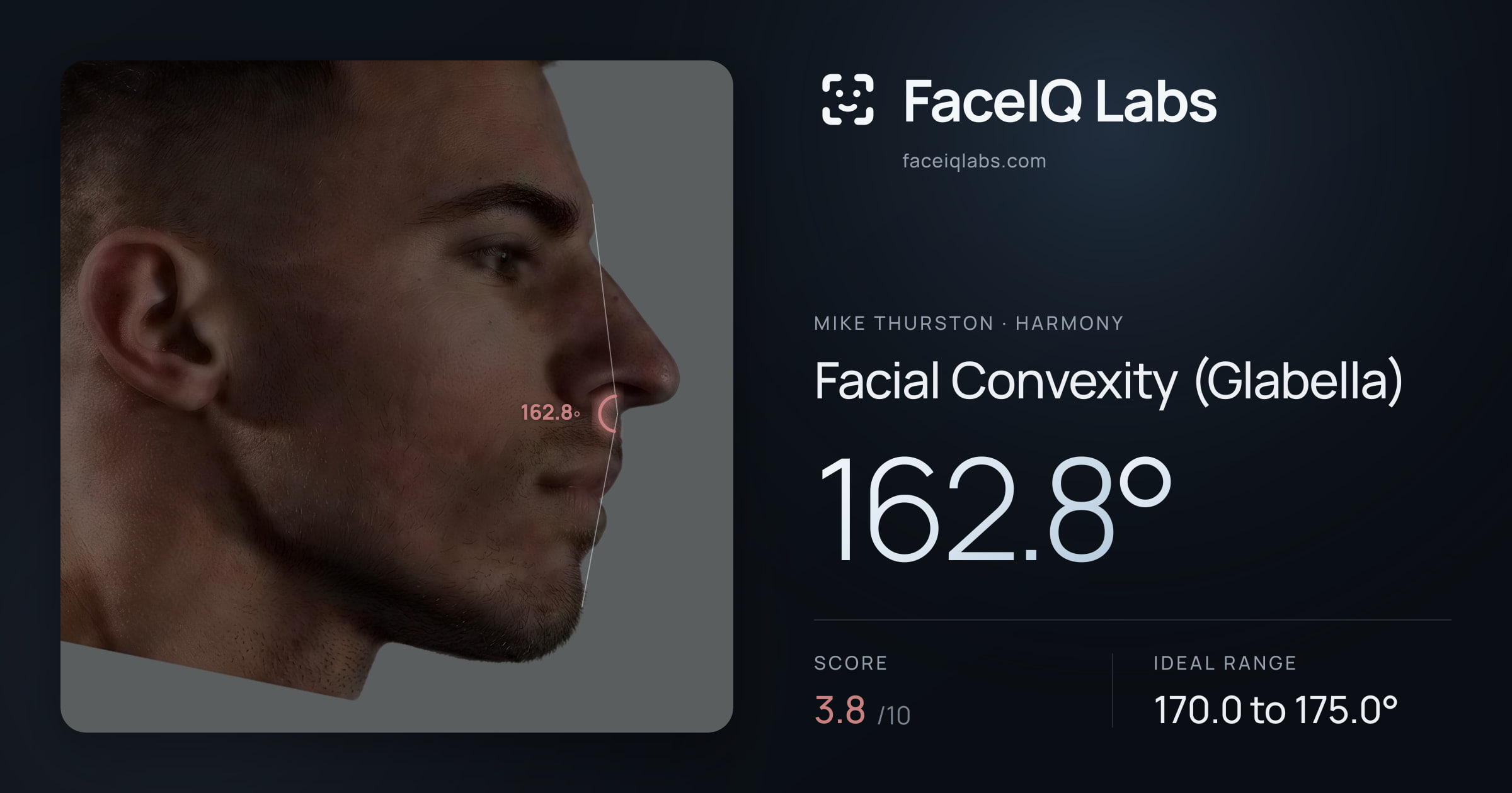 Mike Thurston Facial Convexity (Glabella): 162.8°, drawn on the photo
