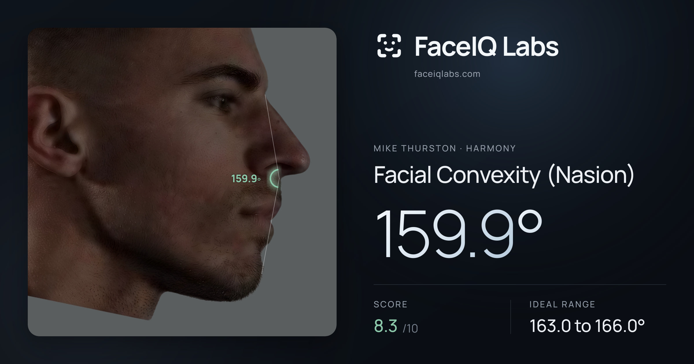 Mike Thurston Facial Convexity (Nasion): 159.9°, drawn on the photo