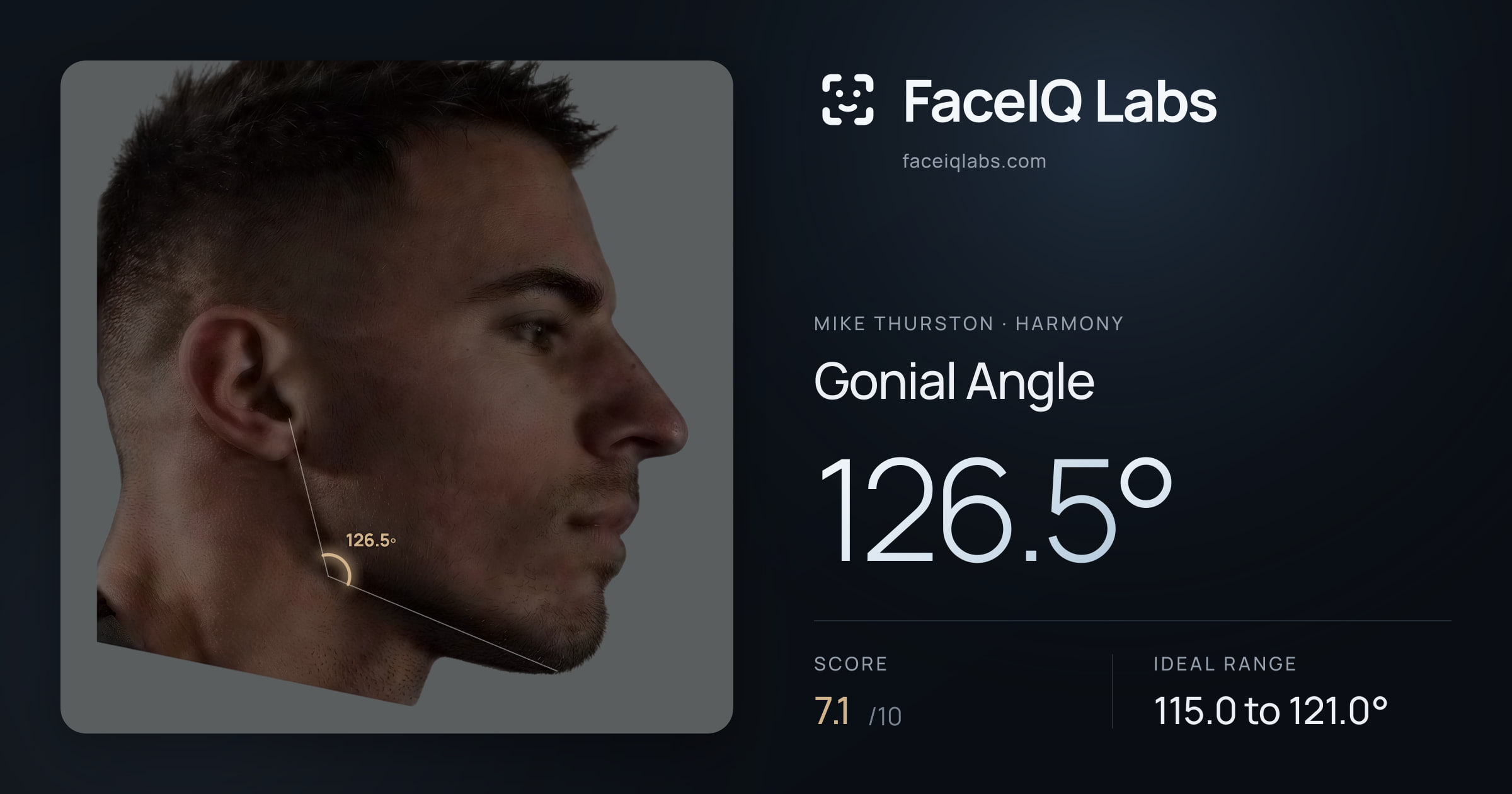 Mike Thurston Gonial Angle: 126.5°, drawn on the photo