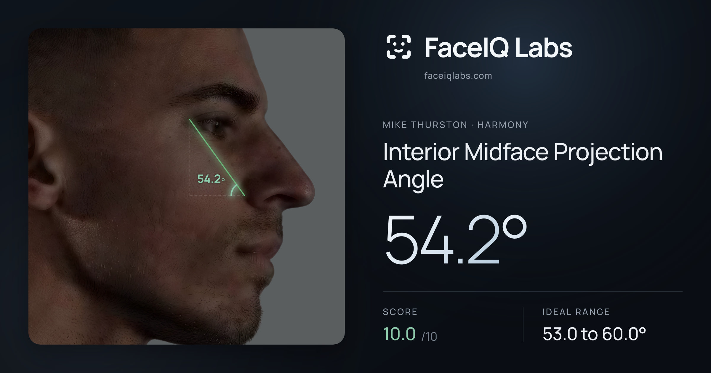 Mike Thurston Interior Midface Projection Angle: 54.2°, drawn on the photo