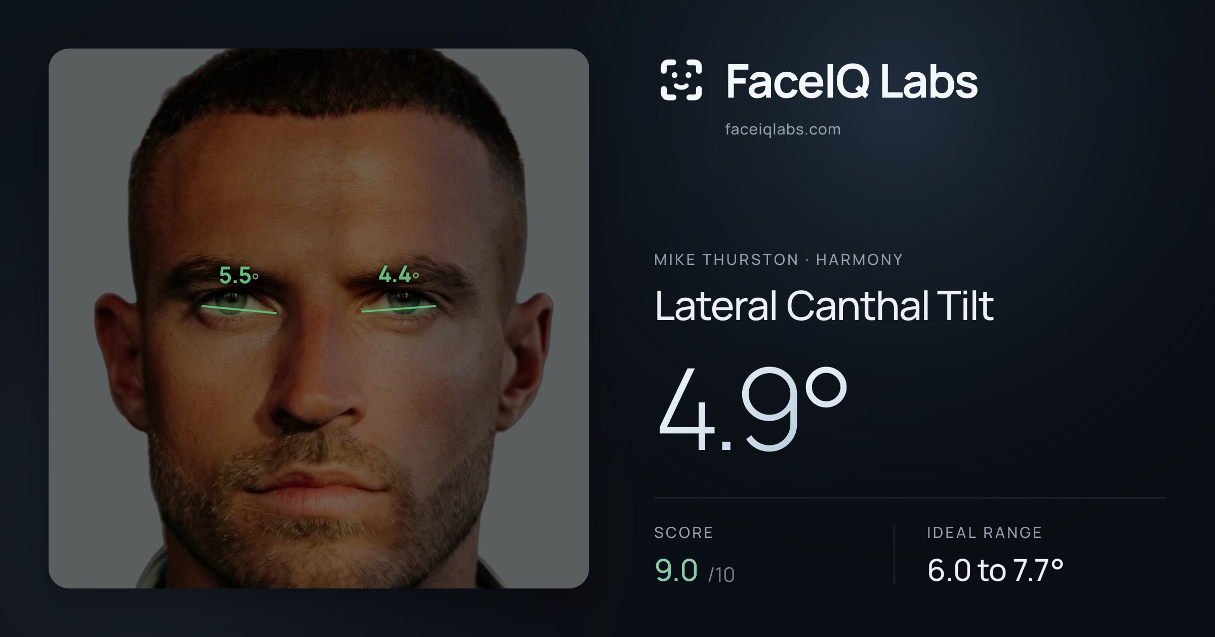 Mike Thurston Lateral Canthal Tilt: 4.9°, drawn on the photo