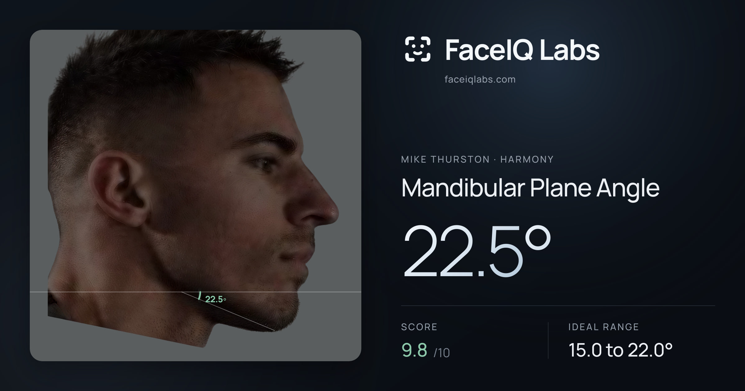 Mike Thurston Mandibular Plane Angle: 22.5°, drawn on the photo