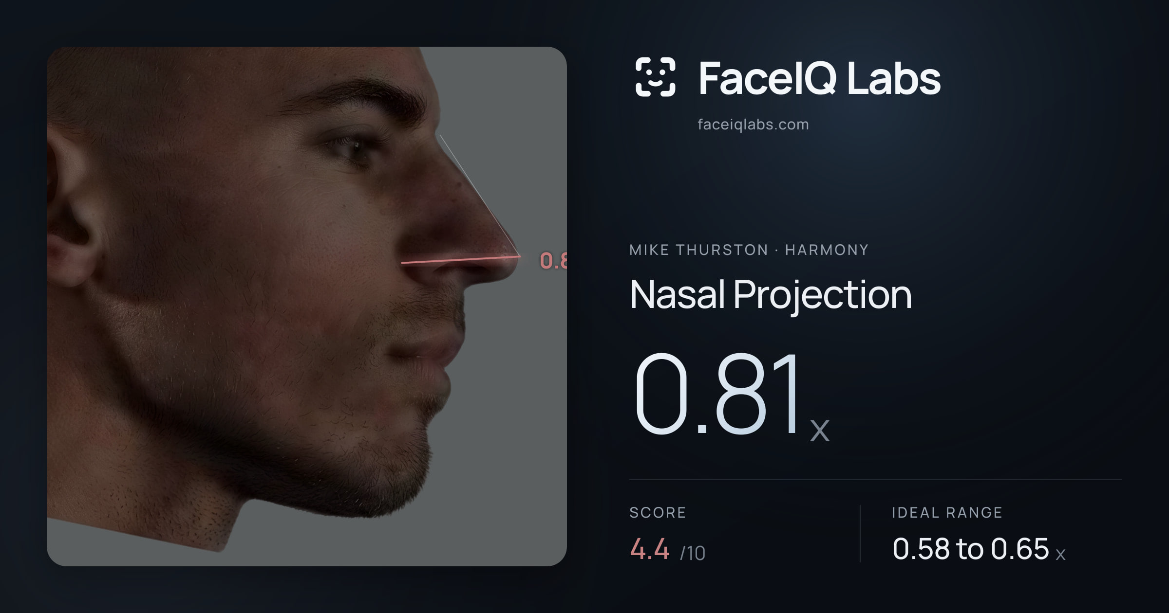 Mike Thurston Nasal Projection: 0.81x, drawn on the photo