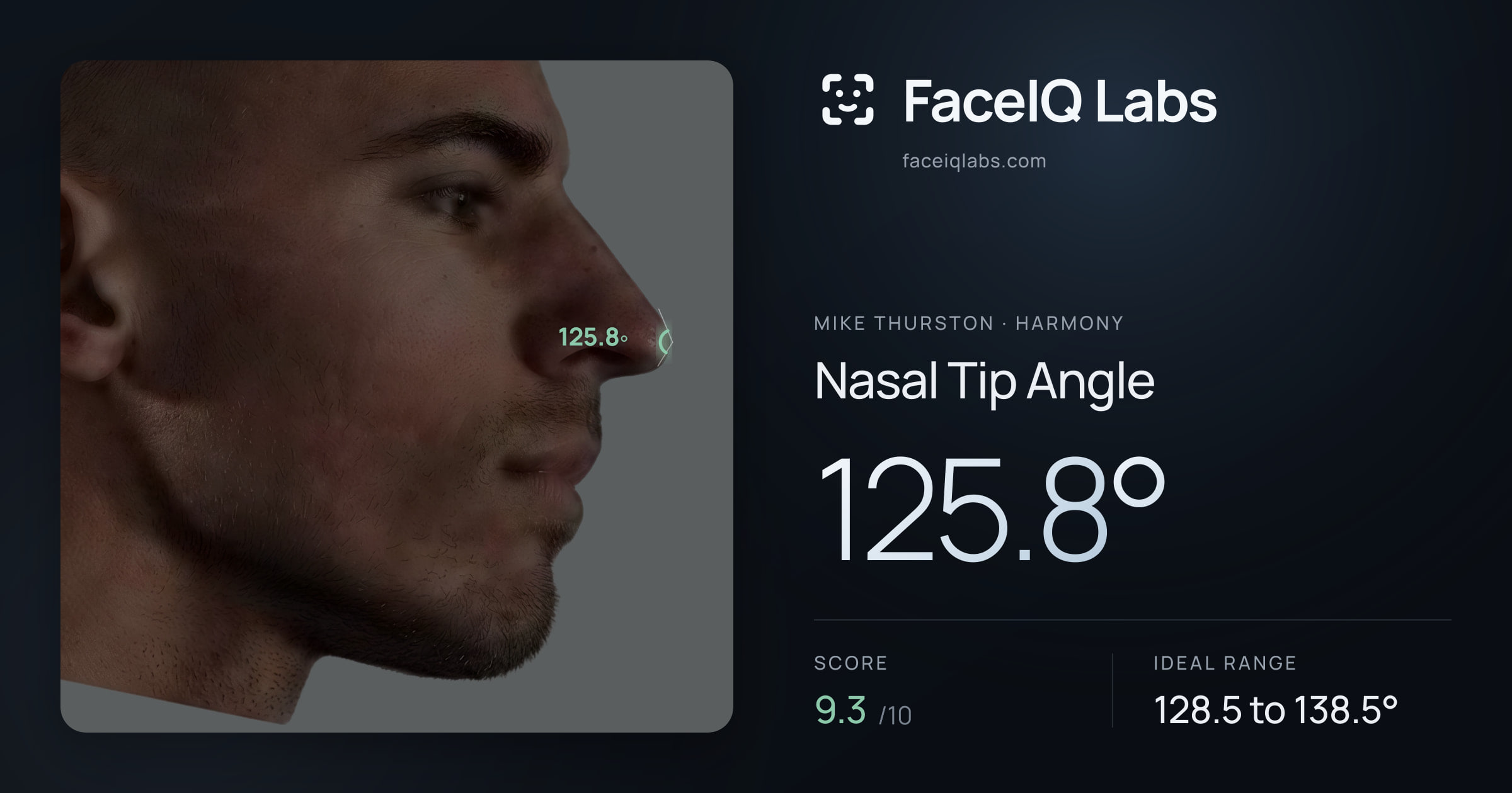 Mike Thurston Nasal Tip Angle: 125.8°, drawn on the photo