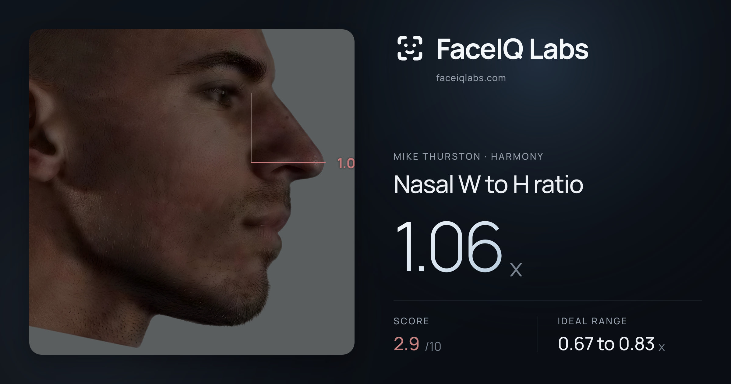 Mike Thurston Nasal W to H ratio: 1.06x, drawn on the photo