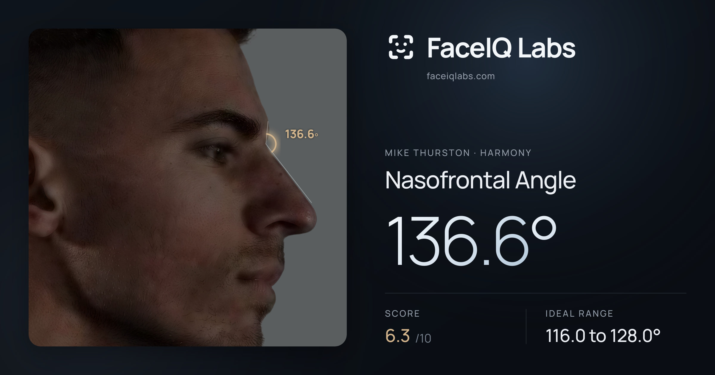 Mike Thurston Nasofrontal Angle: 136.6°, drawn on the photo