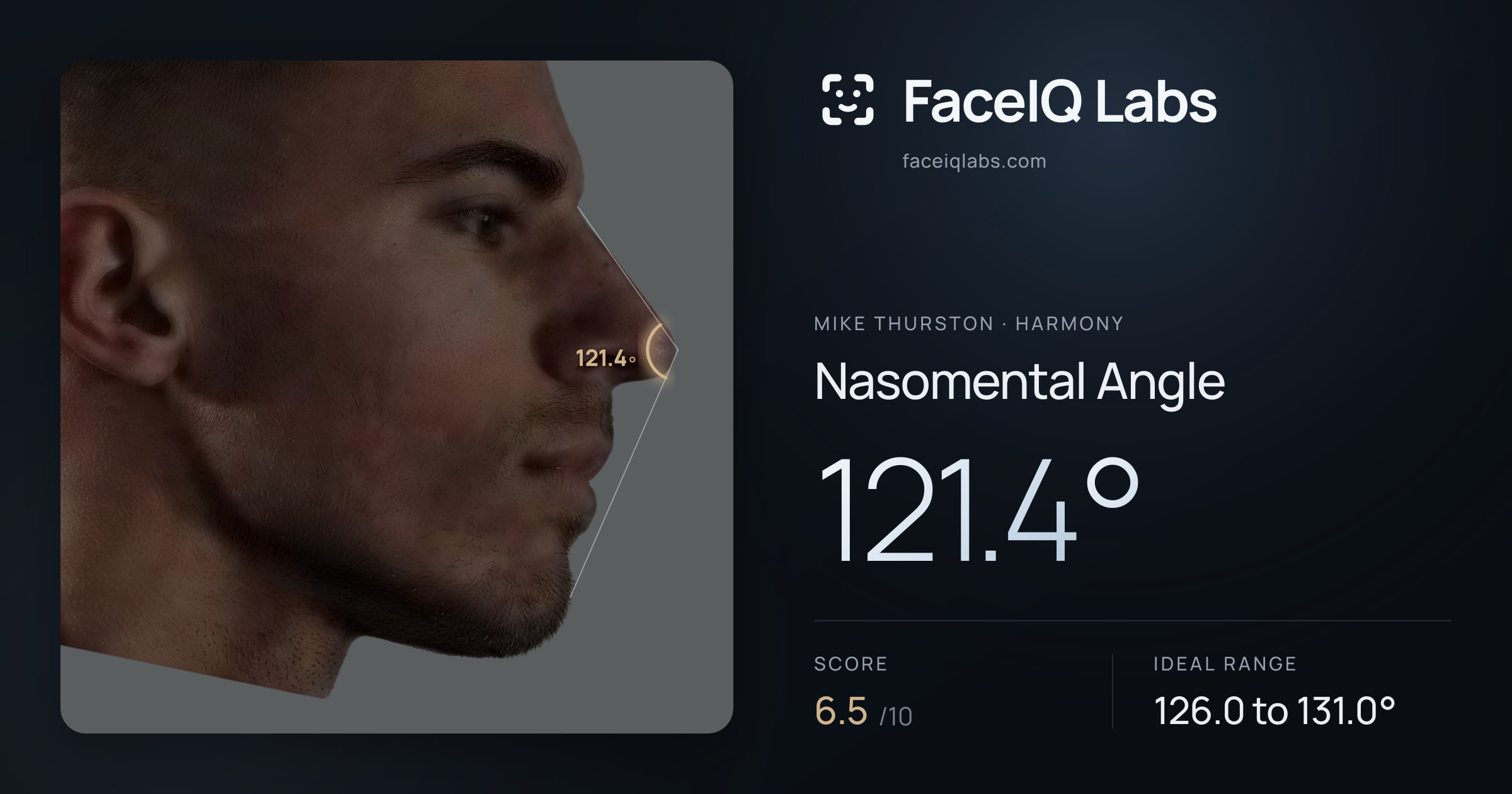 Mike Thurston Nasomental Angle: 121.4°, drawn on the photo