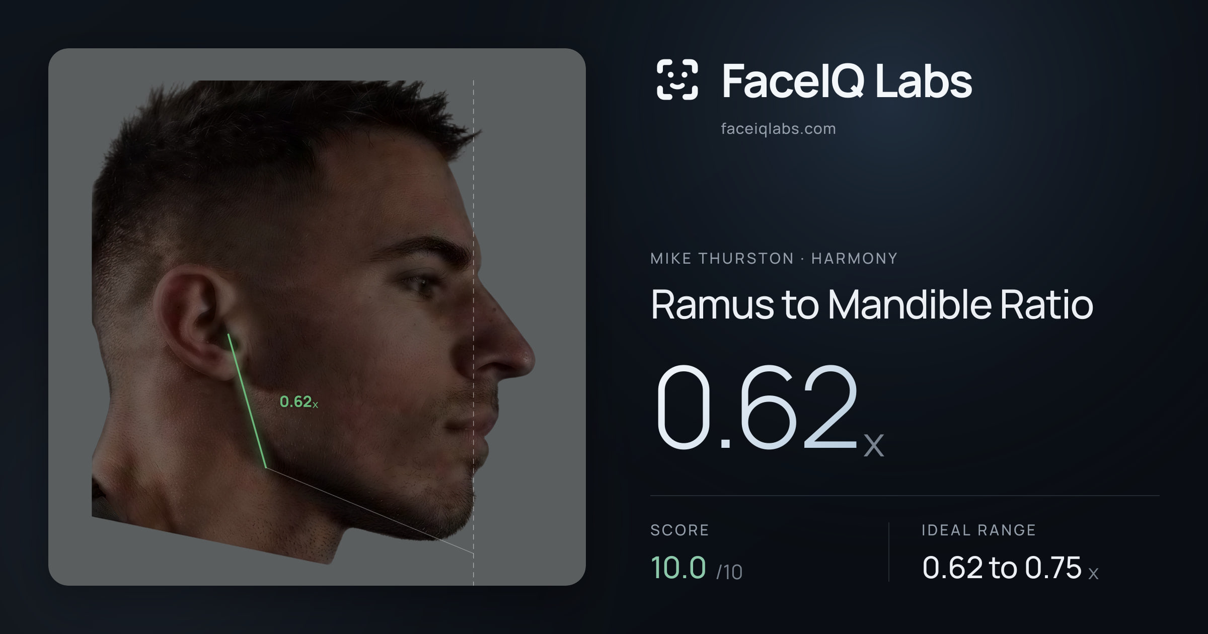Mike Thurston Ramus to Mandible Ratio: 0.62x, drawn on the photo