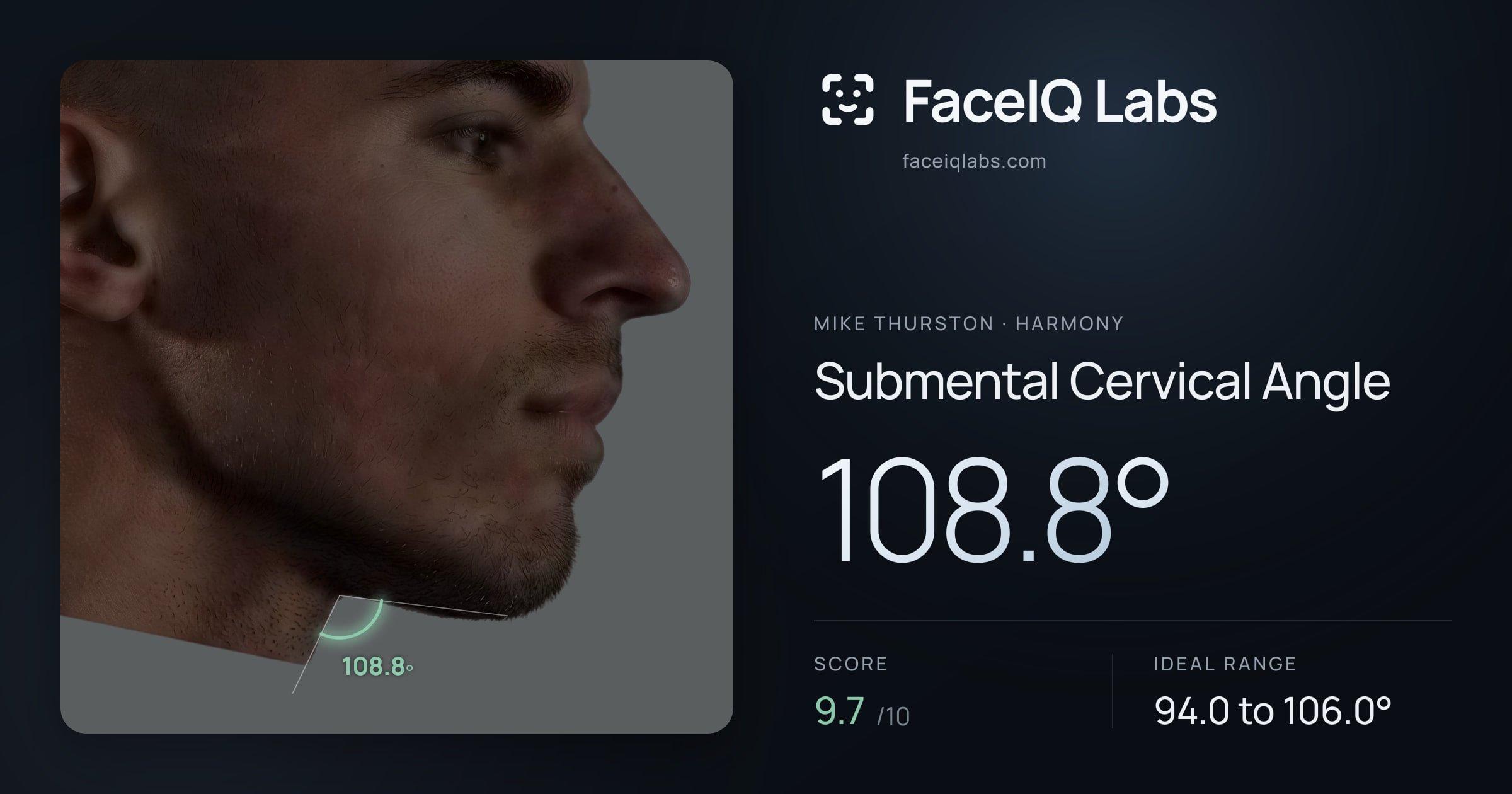 Mike Thurston Submental Cervical Angle: 108.8°, drawn on the photo