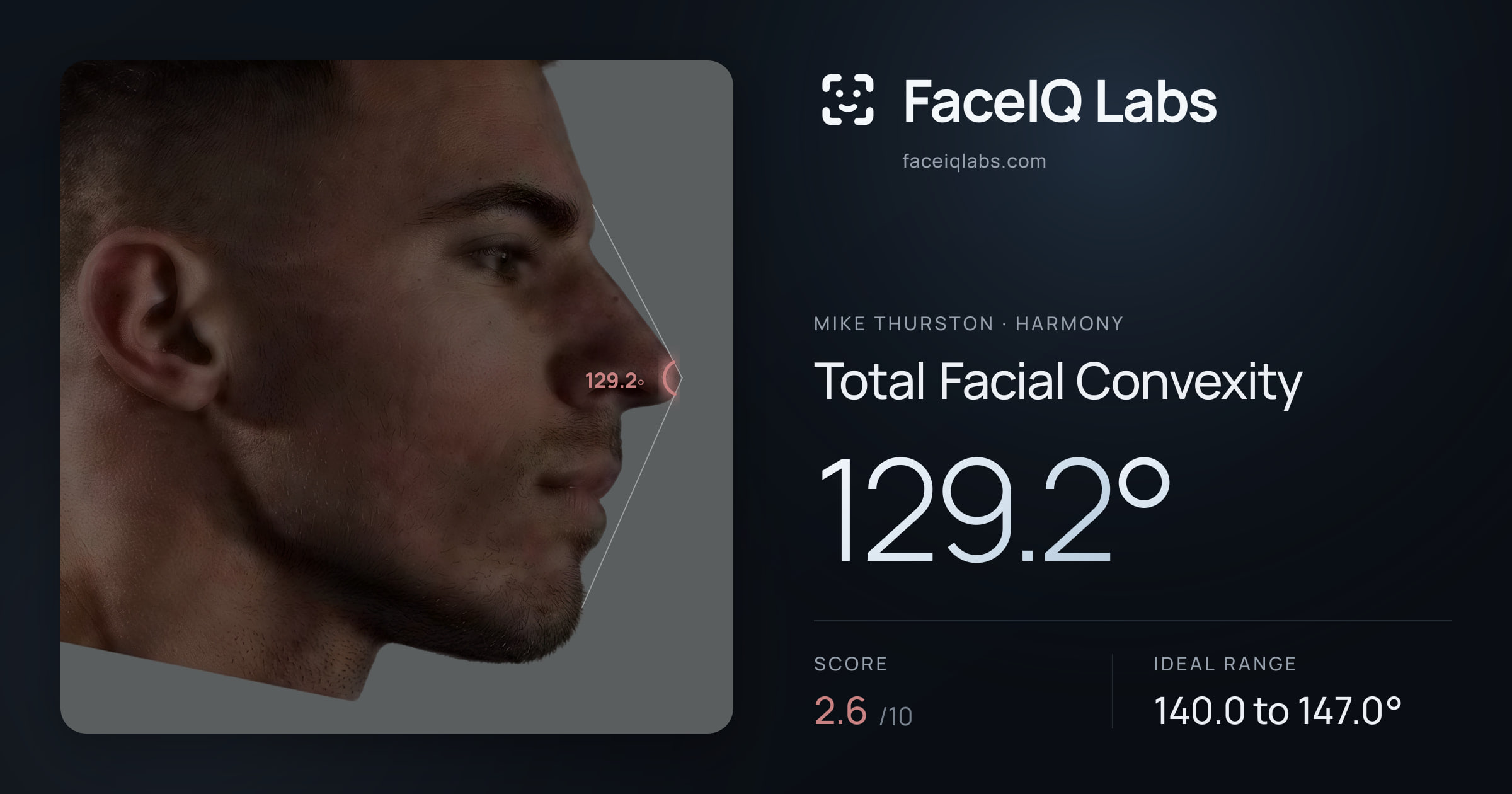 Mike Thurston Total Facial Convexity: 129.2°, drawn on the photo