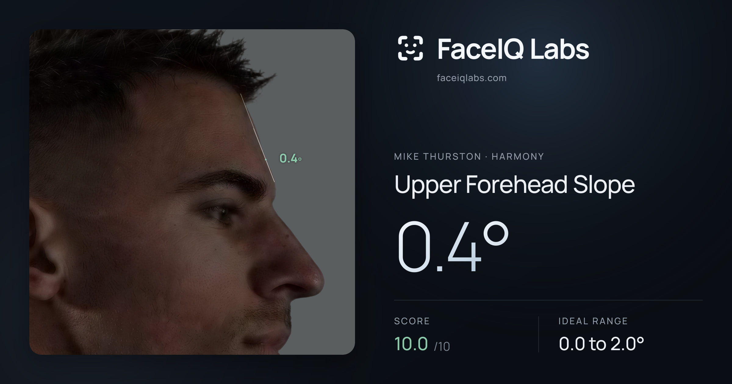 Mike Thurston Upper Forehead Slope: 0.4°, drawn on the photo