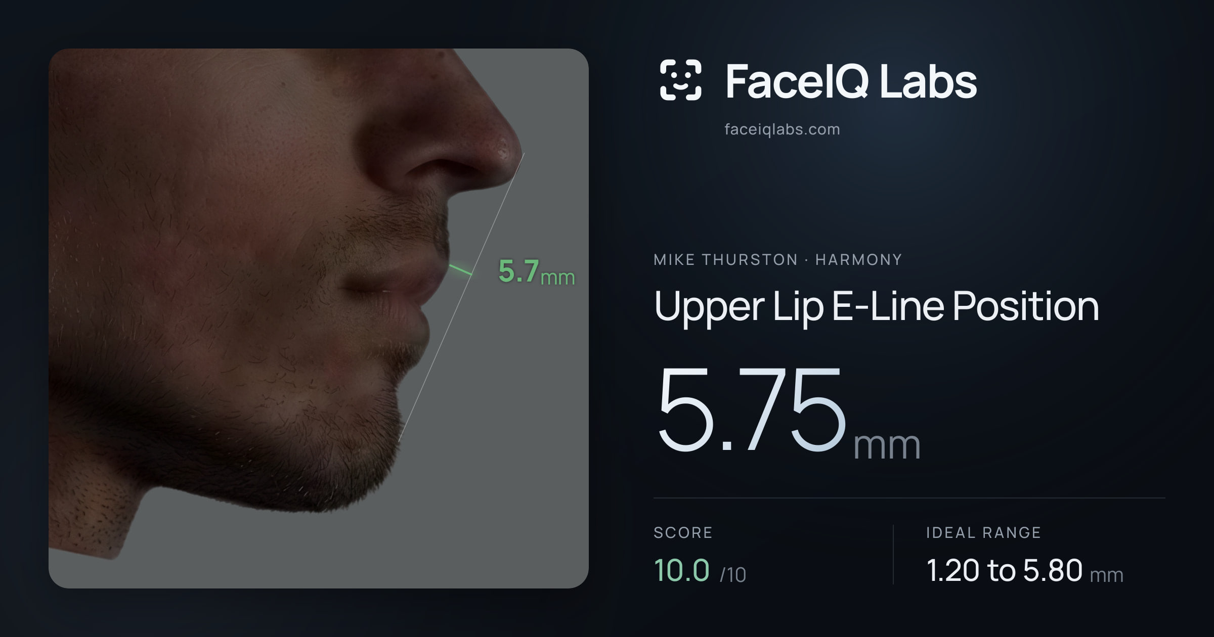 Mike Thurston Upper Lip E-Line Position: 5.75mm, drawn on the photo