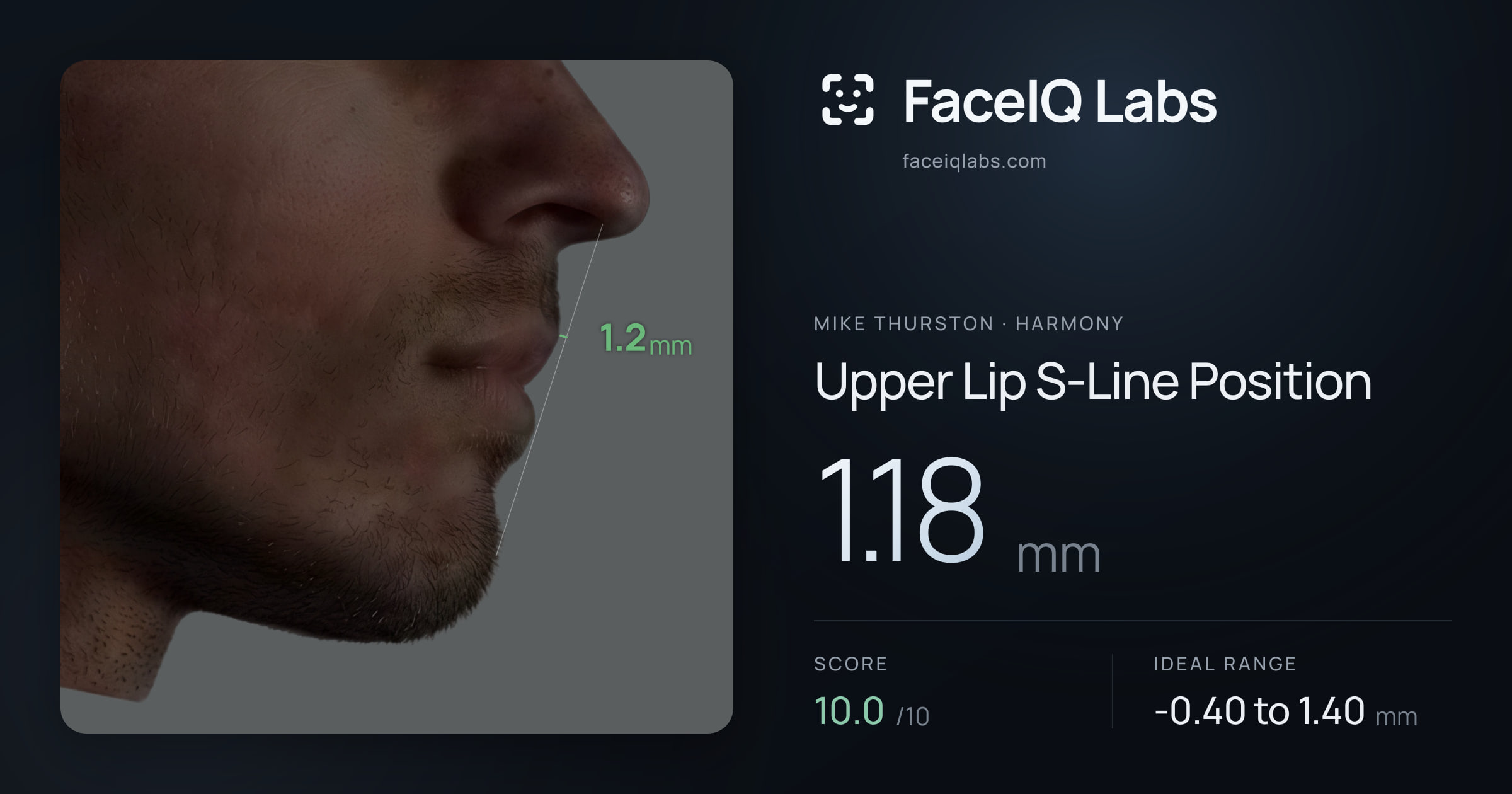 Mike Thurston Upper Lip S-Line Position: 1.18mm, drawn on the photo