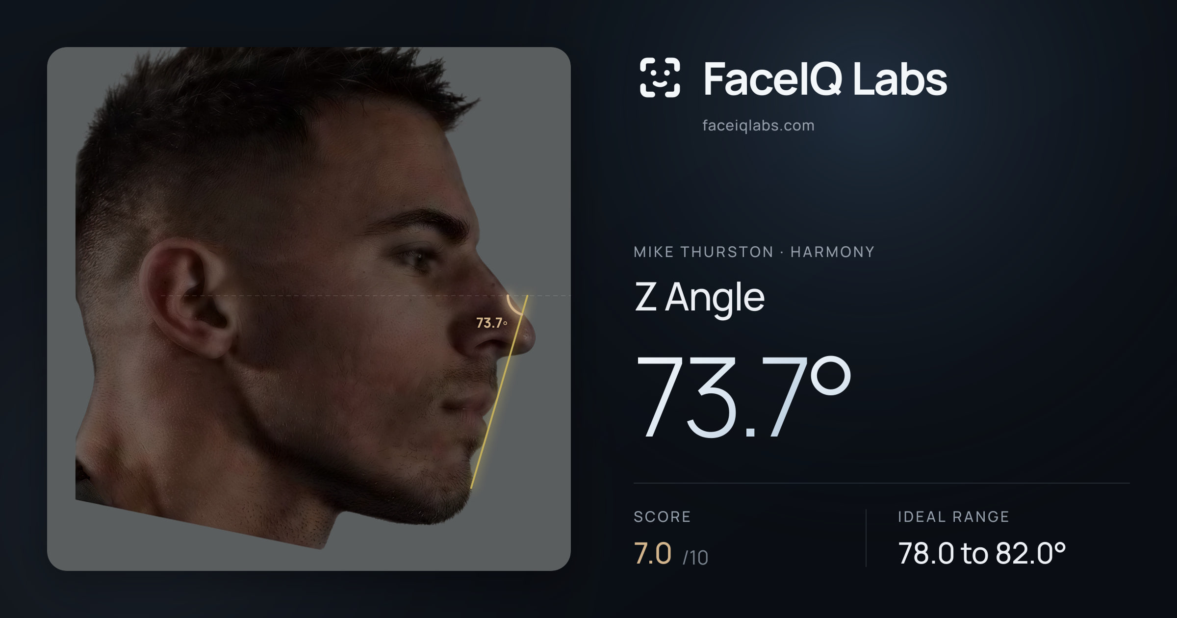 Mike Thurston Z Angle: 73.7°, drawn on the photo
