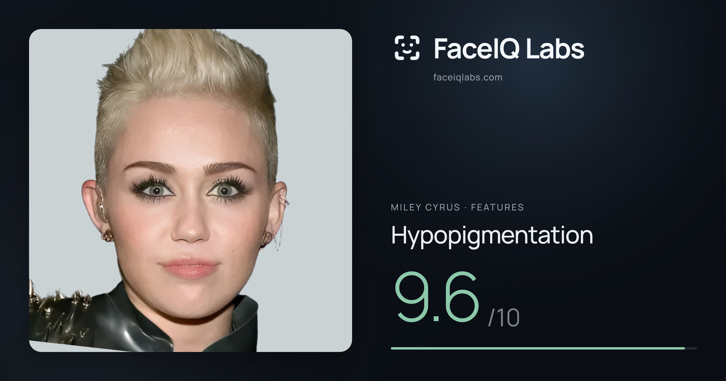 Miley Cyrus Hypopigmentation: 9.6/10, drawn on the photo
