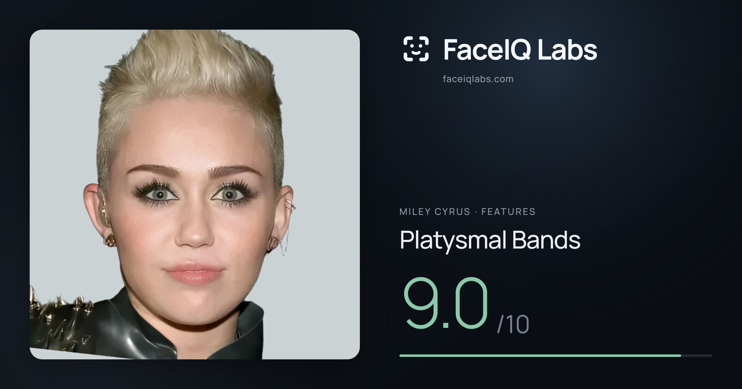 Miley Cyrus Platysmal Bands: 9.0/10, drawn on the photo