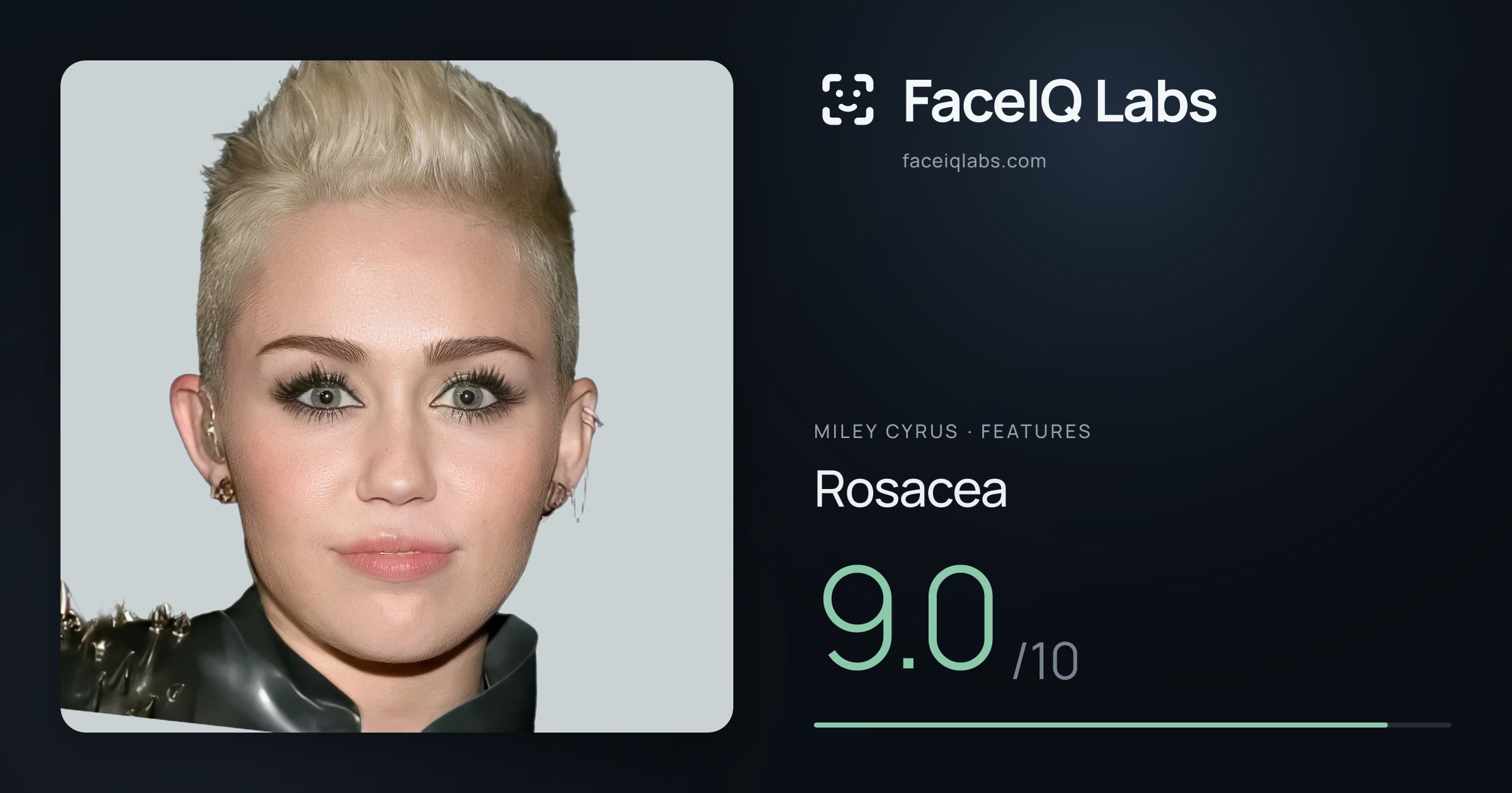 Miley Cyrus Rosacea: 9.0/10, drawn on the photo