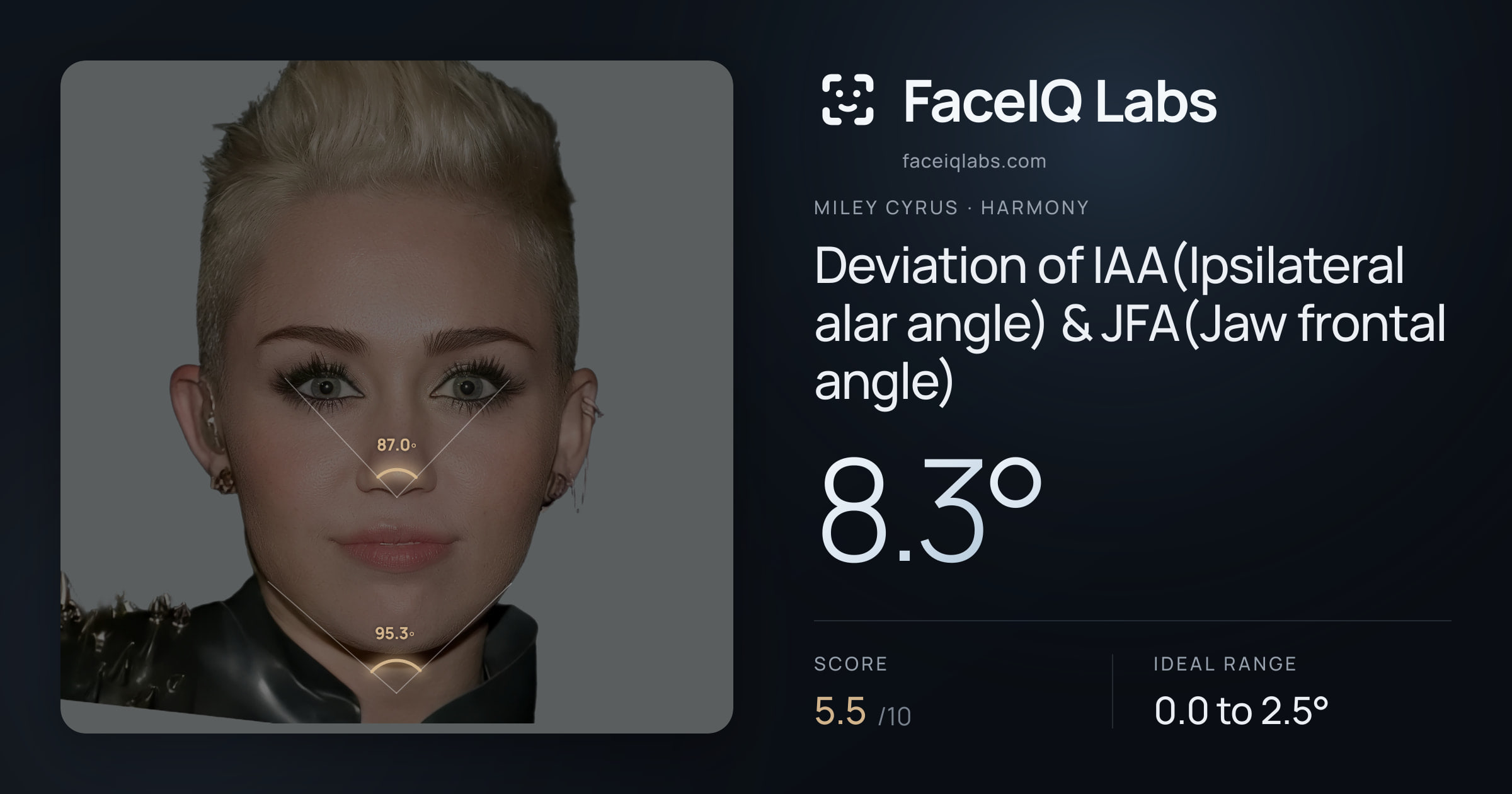 Miley Cyrus Deviation of IAA(Ipsilateral alar angle) & JFA(Jaw frontal angle): 8.3°, drawn on the photo