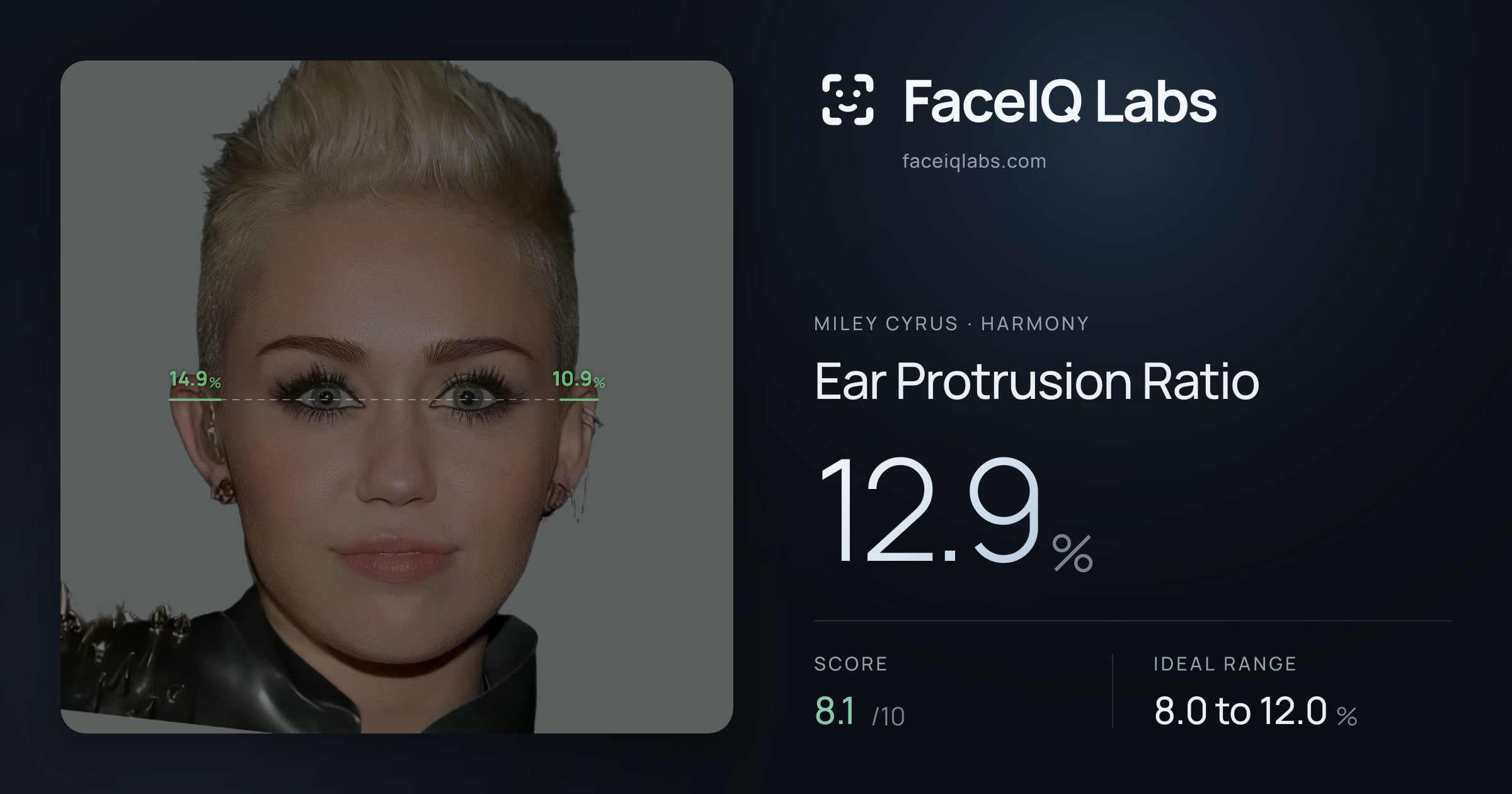 Miley Cyrus Ear Protrusion Ratio: 12.9%, drawn on the photo