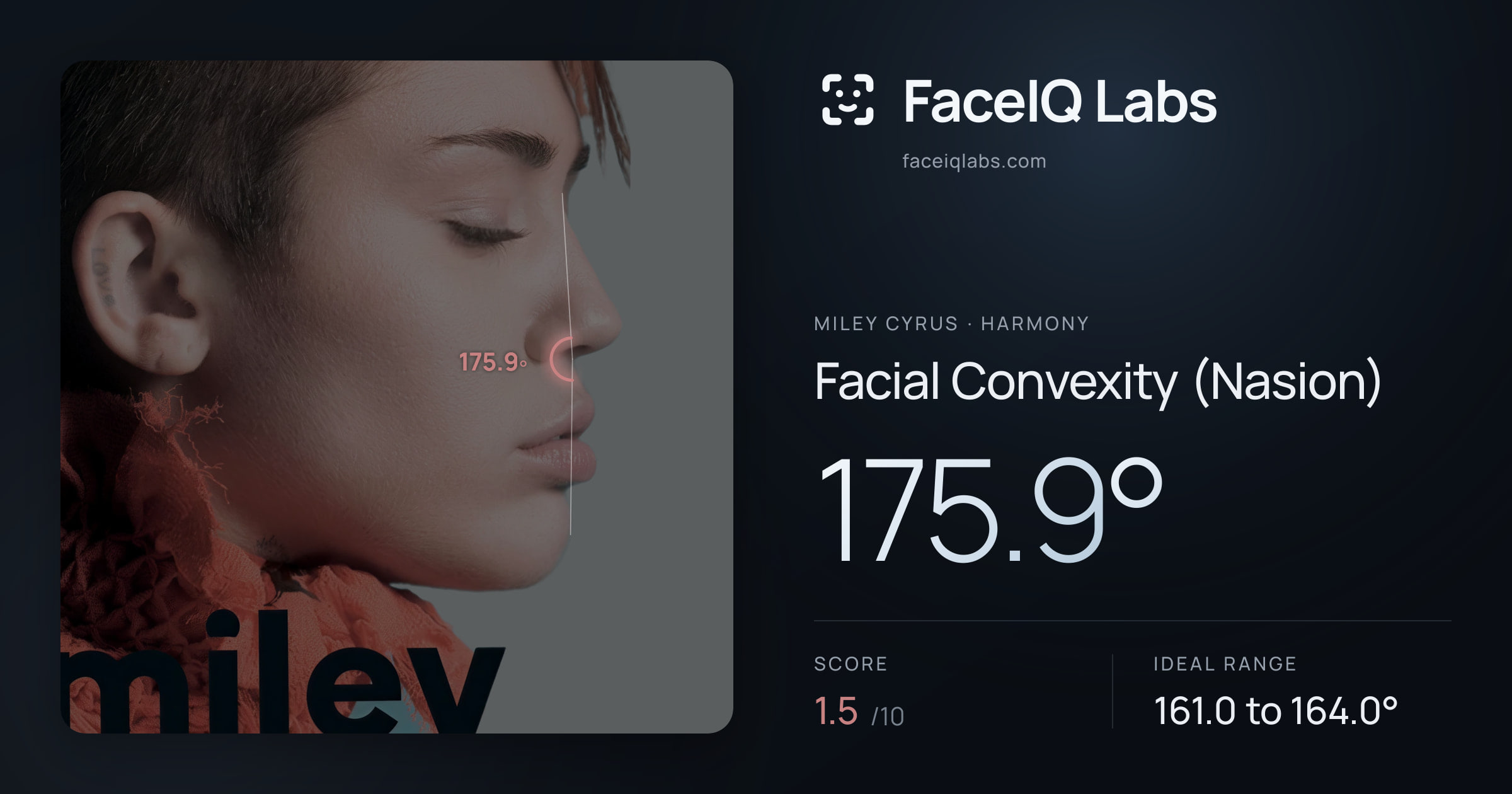 Miley Cyrus Facial Convexity (Nasion): 175.9°, drawn on the photo