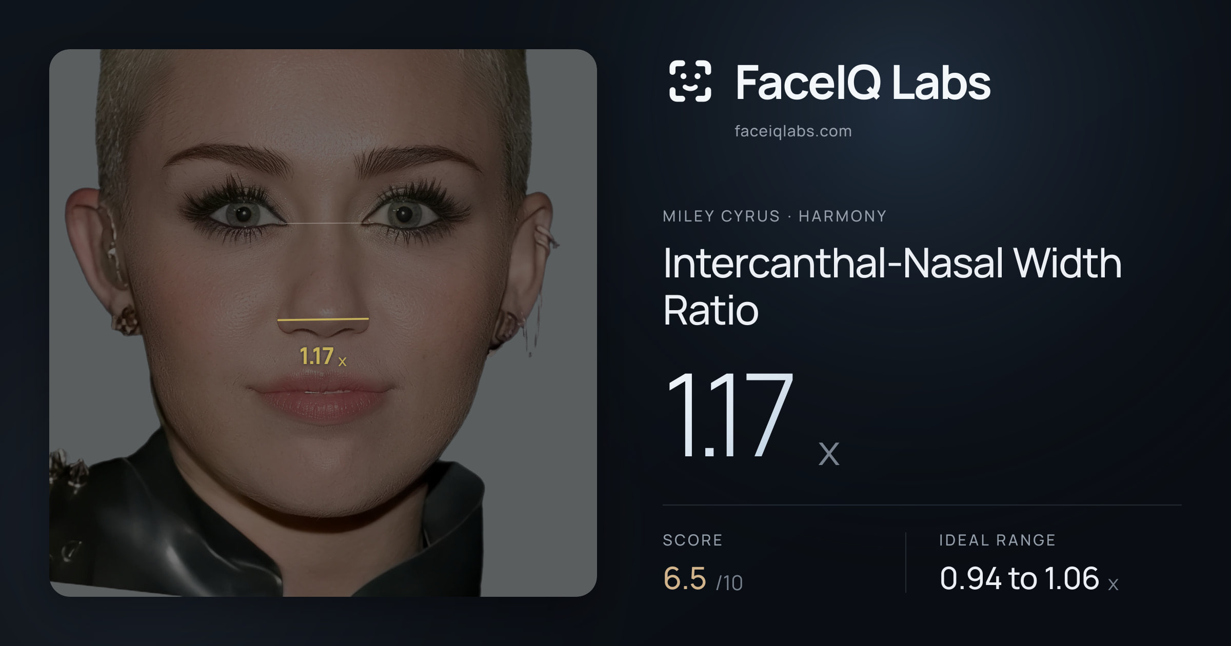 Miley Cyrus Intercanthal-Nasal Width Ratio: 1.17x, drawn on the photo