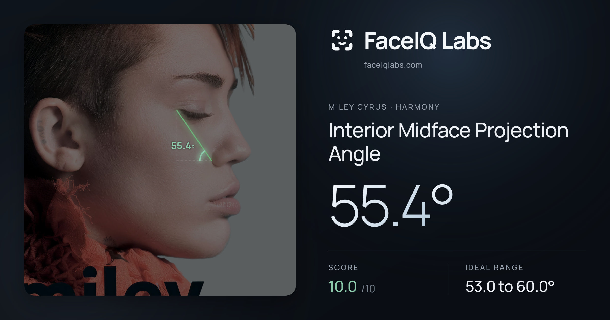 Miley Cyrus Interior Midface Projection Angle: 55.4°, drawn on the photo