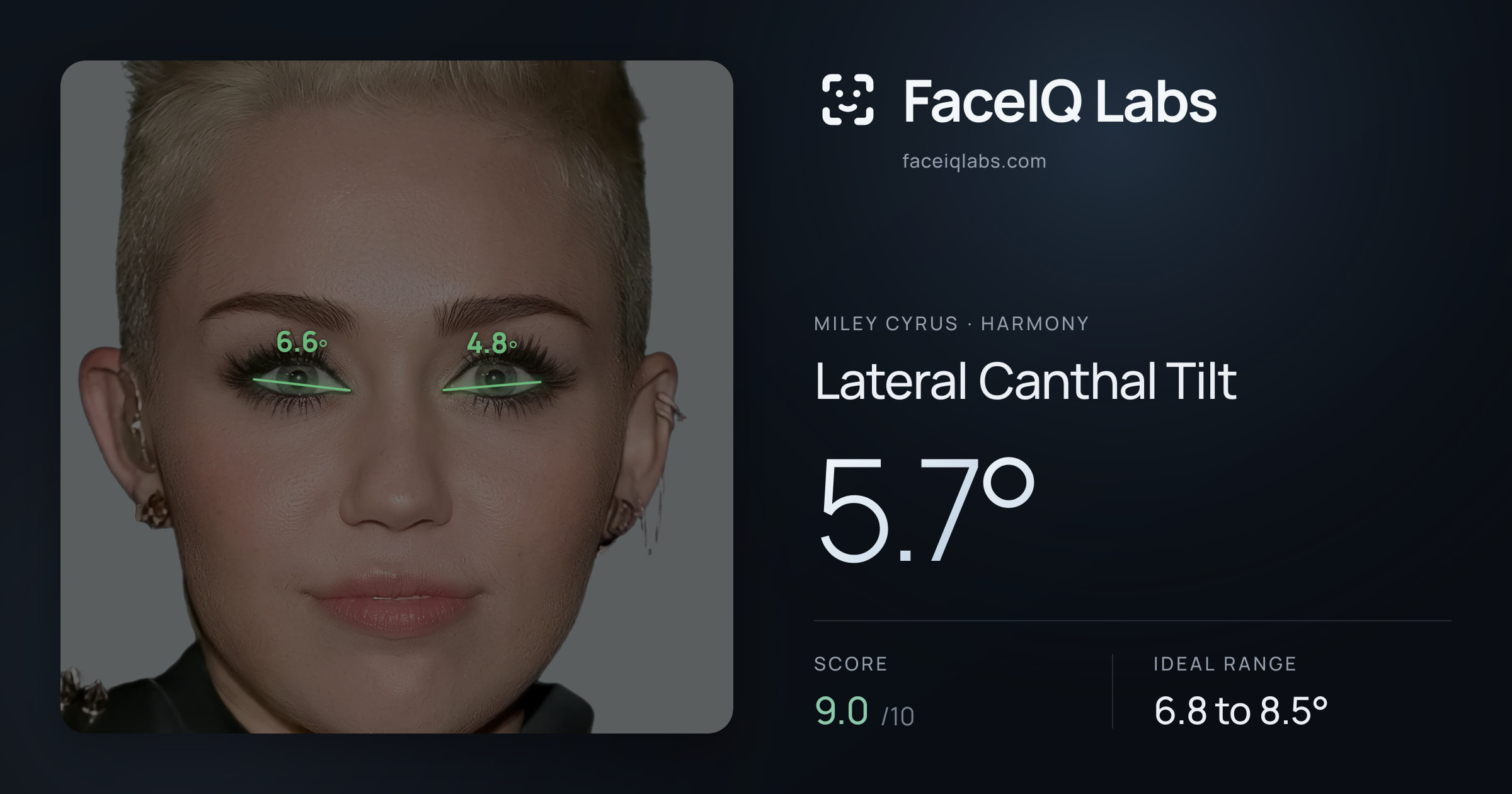 Miley Cyrus Lateral Canthal Tilt: 5.7°, drawn on the photo