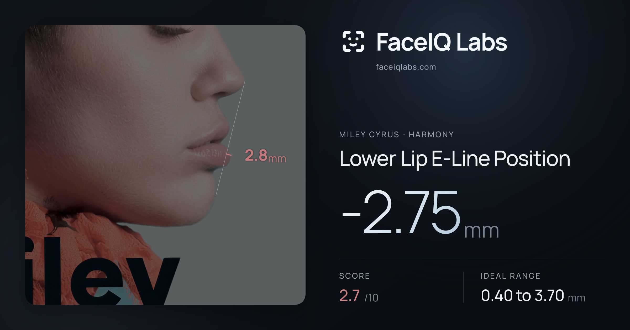 Miley Cyrus Lower Lip E-Line Position: -2.75mm, drawn on the photo
