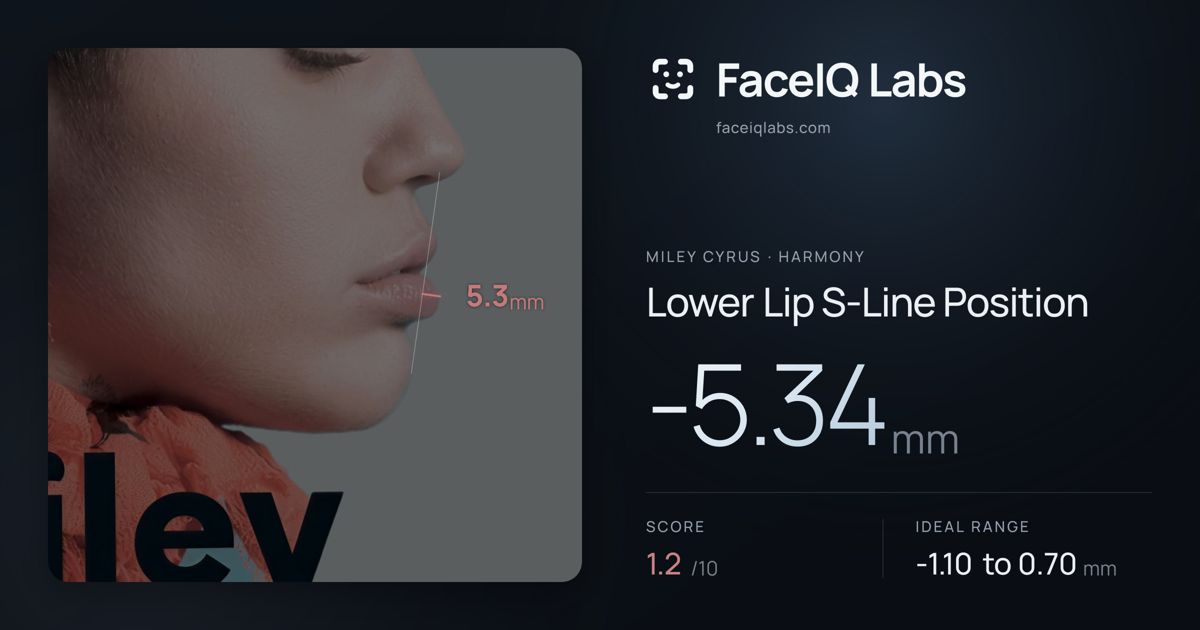 Miley Cyrus Lower Lip S-Line Position: -5.34mm, drawn on the photo